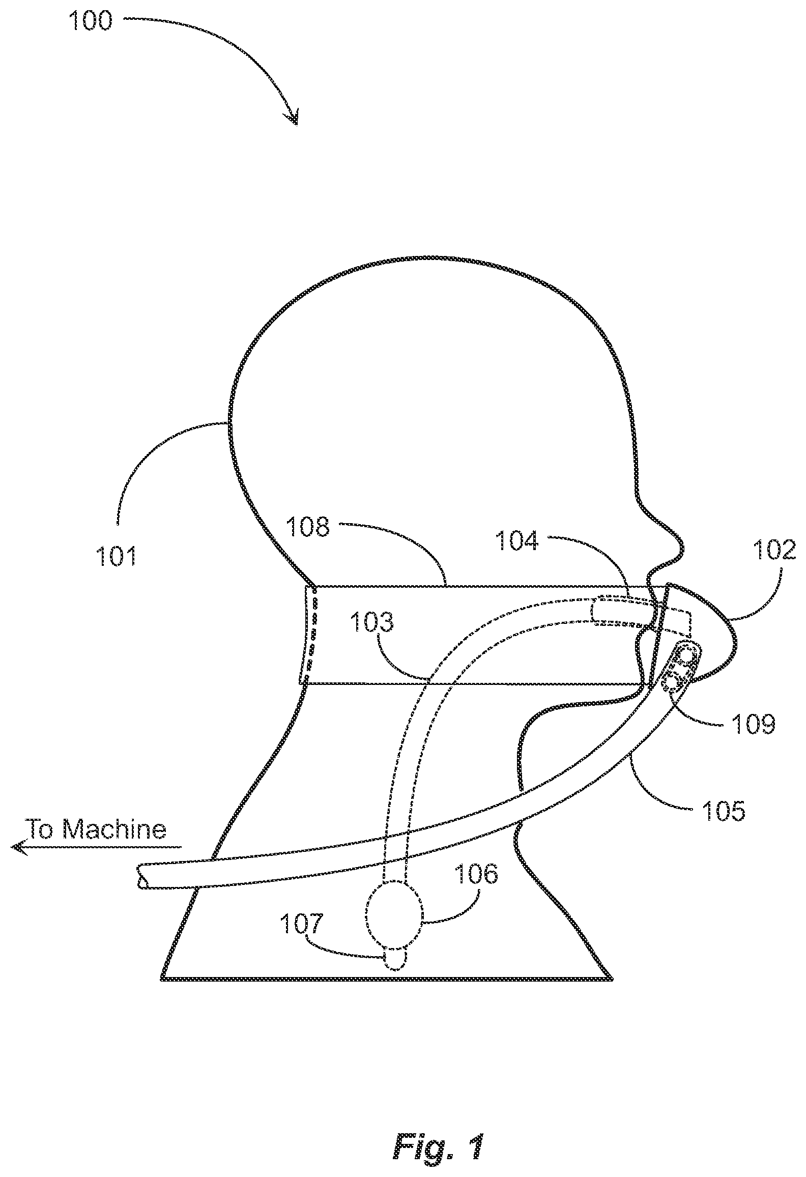 Patent US12599735 — Endotracheal tube attachment system — Figure 1