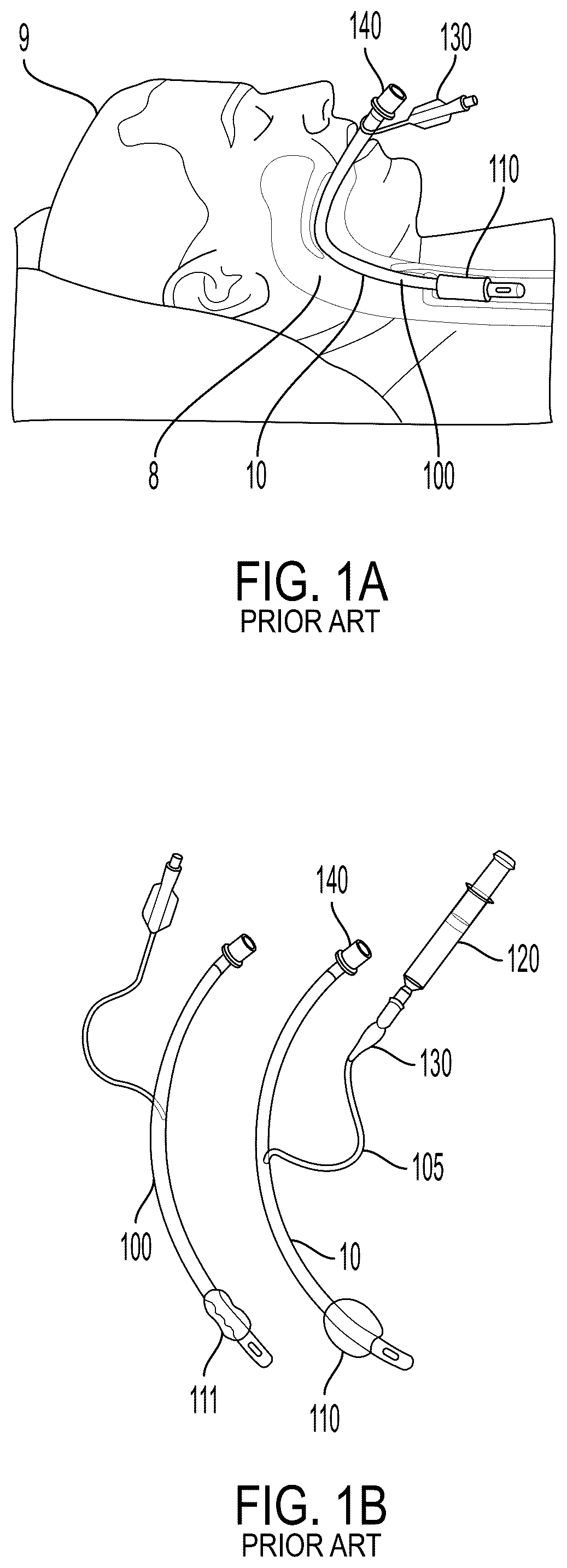 Patent US12599736 — System and method for avoiding leakage in endotracheal tube with single or double cuff — Figure 1