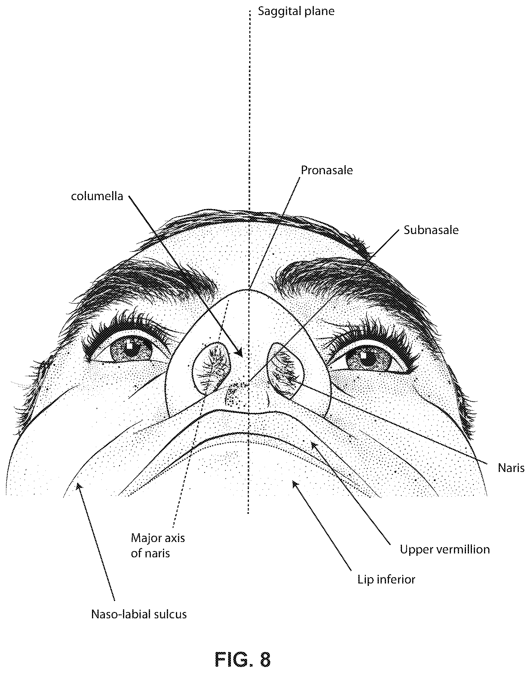 Patent US12599739 Figure 8 – Patient interface with foam cushion