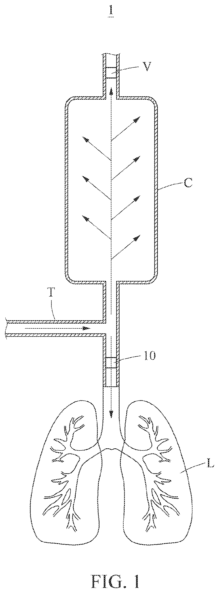 Patent US12599743 — Bidirectional flow-controllable artificial respirator — Figure 1