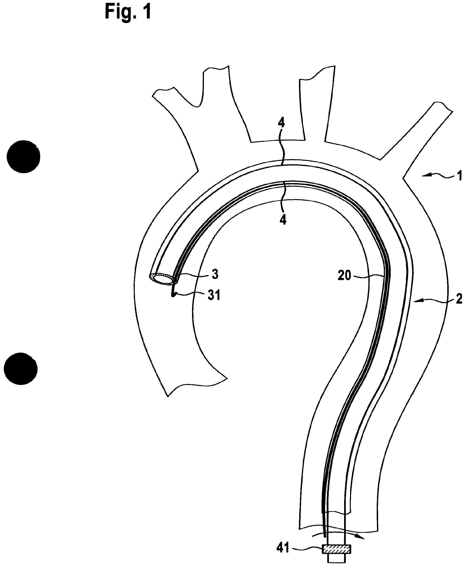 Patent US12599749 — Controllable insertion sleeve — Figure 1