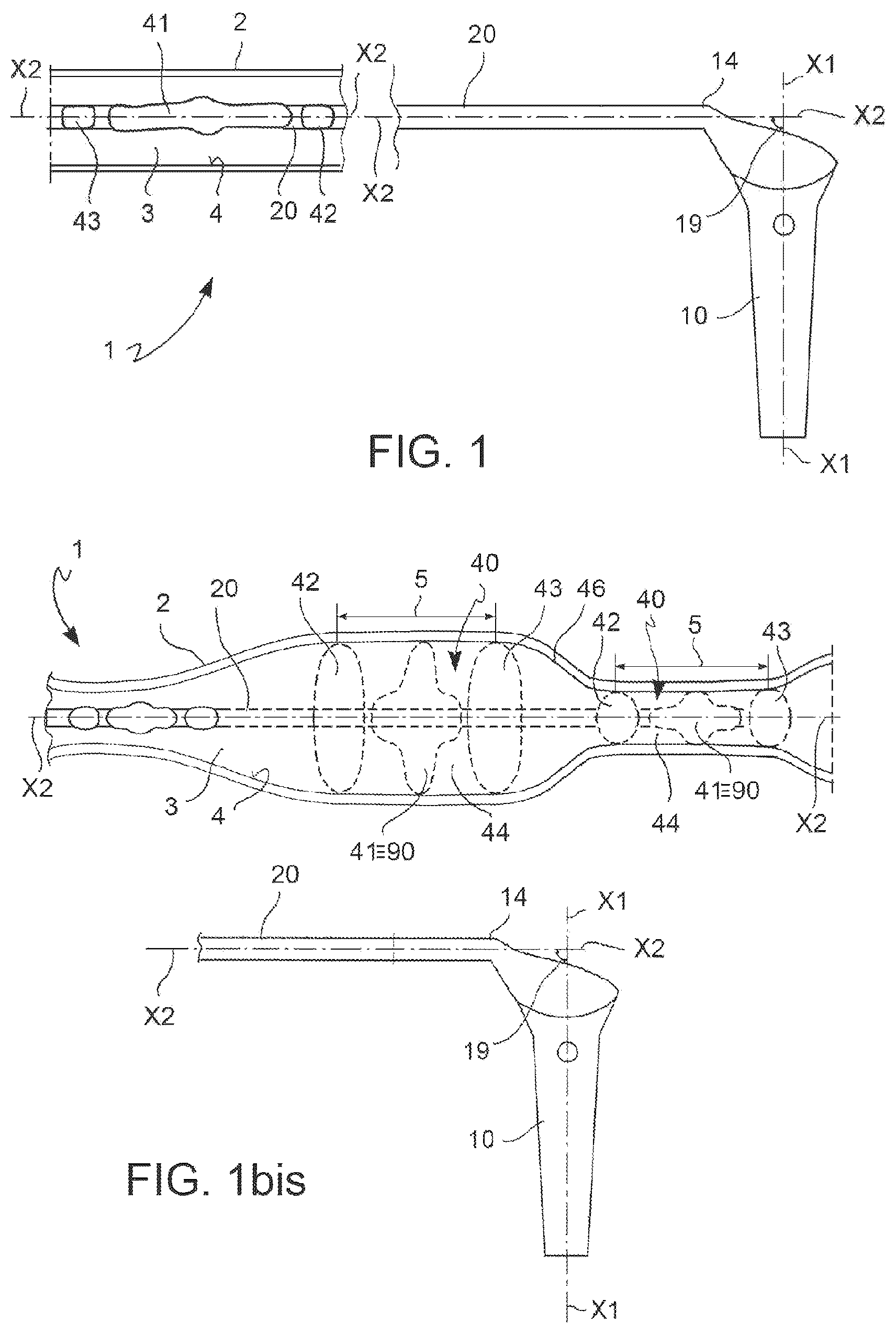 Patent US12599755 — Vascular catheter and method — Figure 1