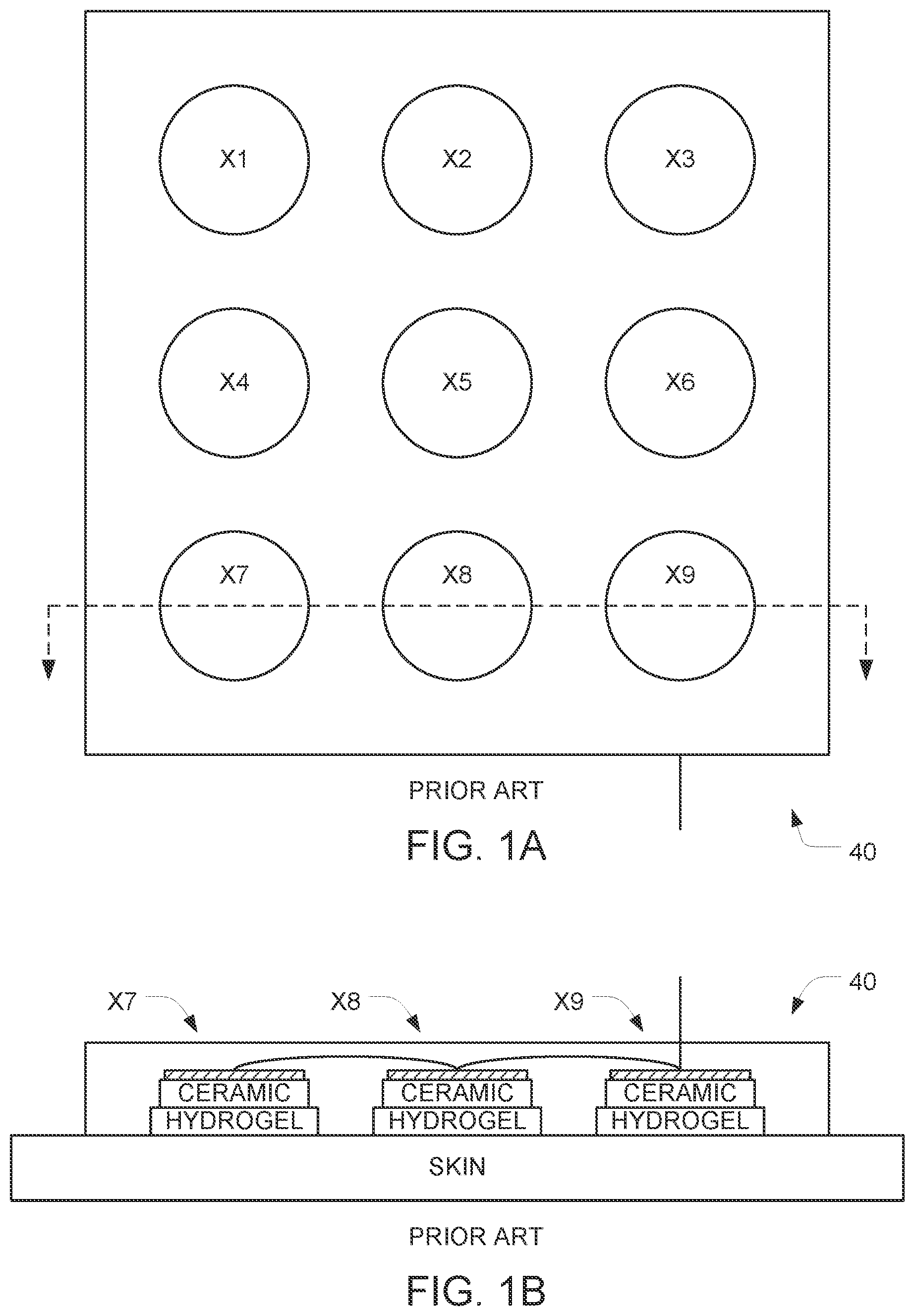Patent US12599761 Figure 1 – Systems and methods for removing and replacing conductive adhesive layers of an electrode array