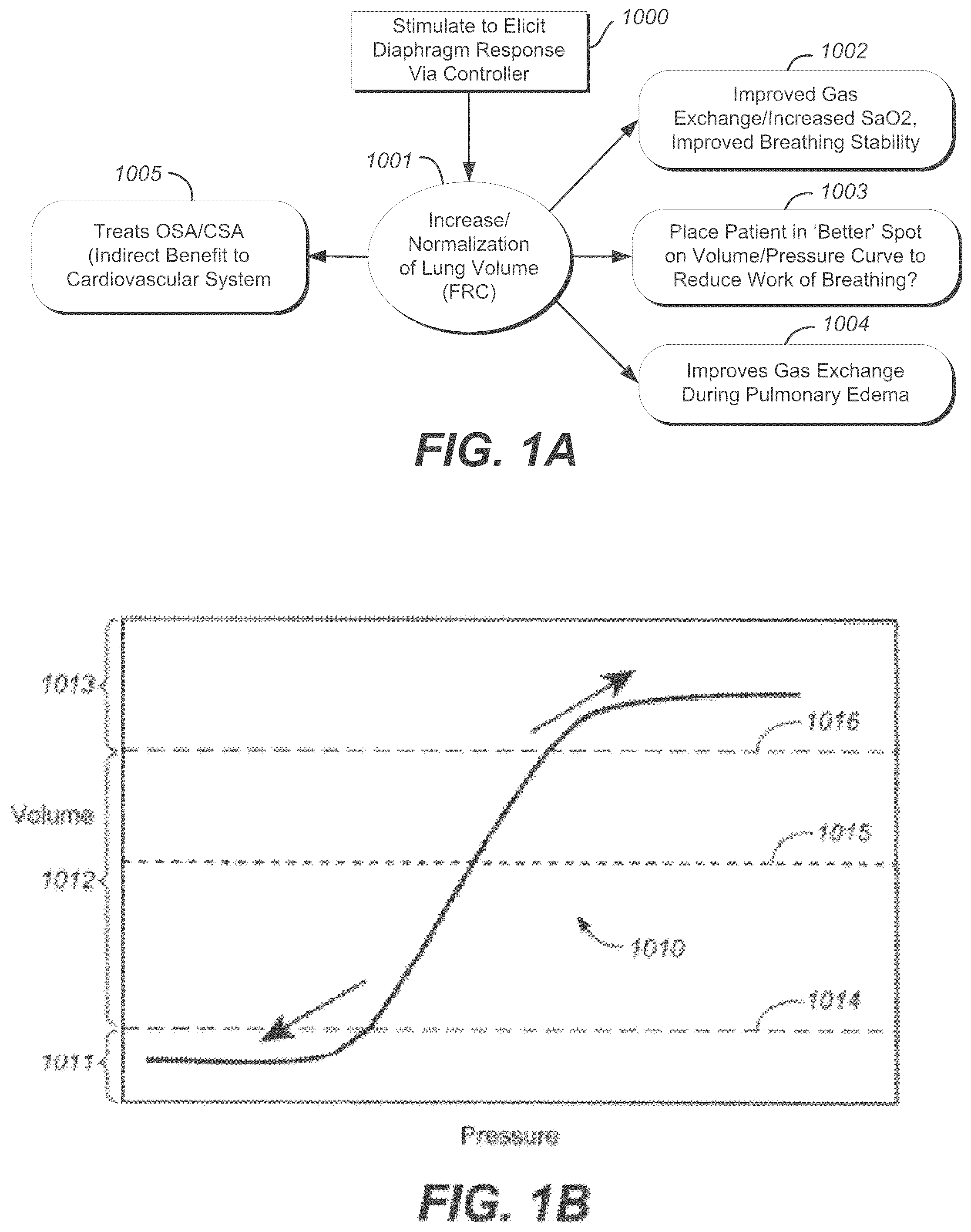 Patent US12599763 — Endovascular lead design and delivery systems — Figure 1