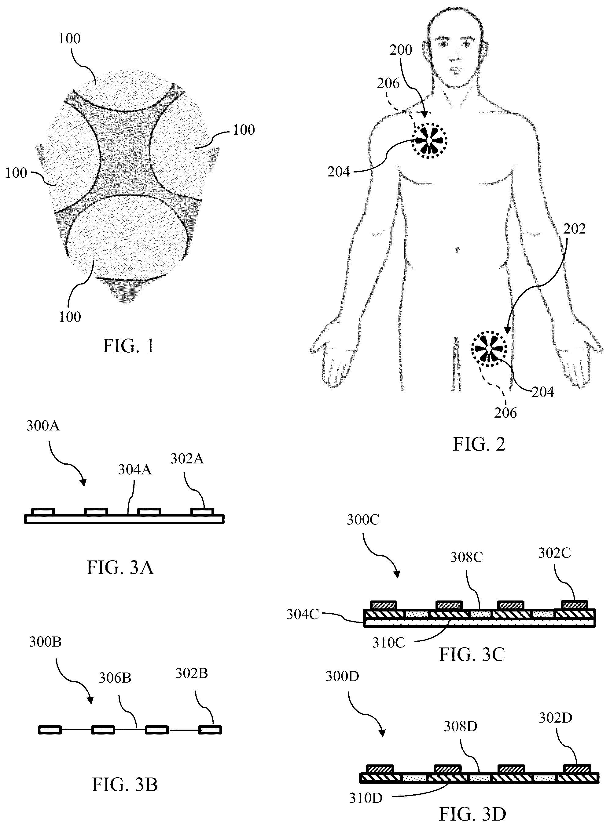 Patent US12599765 — Shifting of transducer array to reduce skin irritation — Figure 1