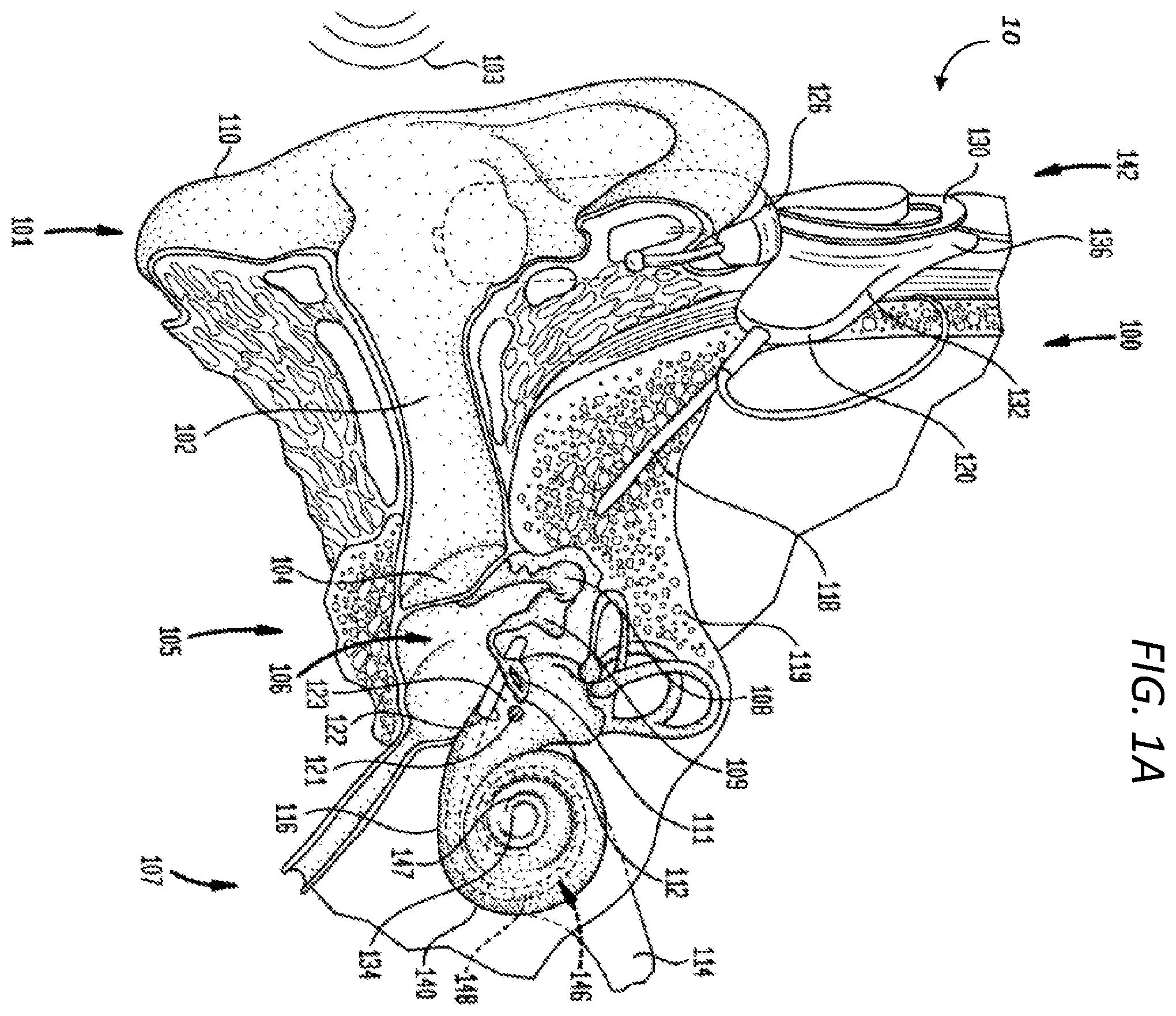 Patent US12599768 — Advanced electrode data analysis — Figure 1