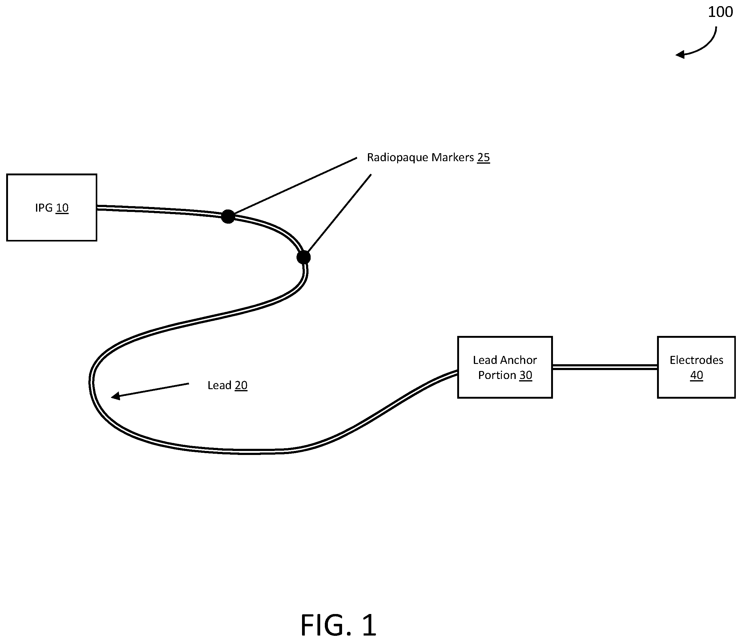 Patent US12599770 — Energy efficient electrical pulse generating device — Figure 1
