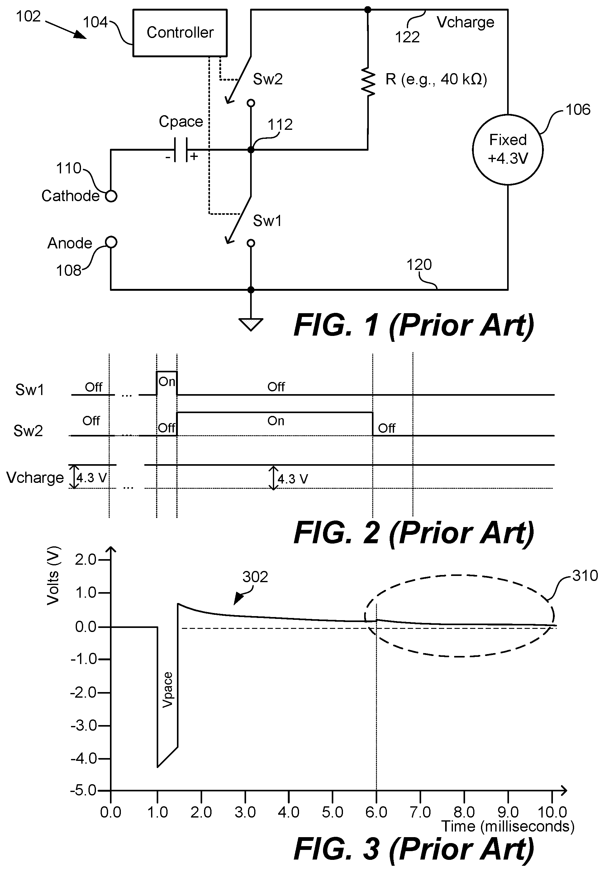 Patent US12599771 — Methods and devices for improved evoked response detection — Figure 1