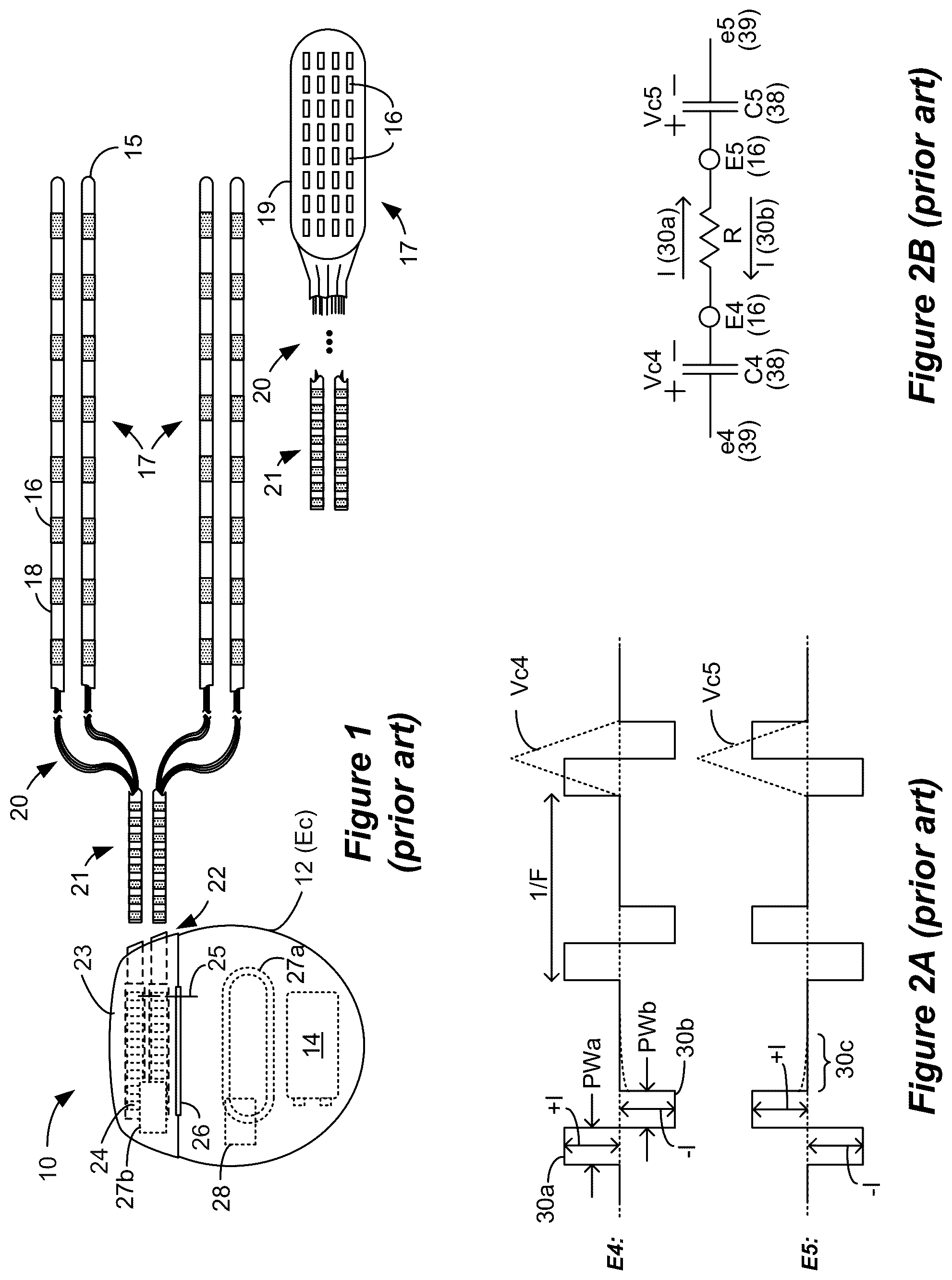 Patent US12599772 Figure 1 – Selection of sensing electrodes in a spinal cord stimulator system using sensed stimulation artifacts