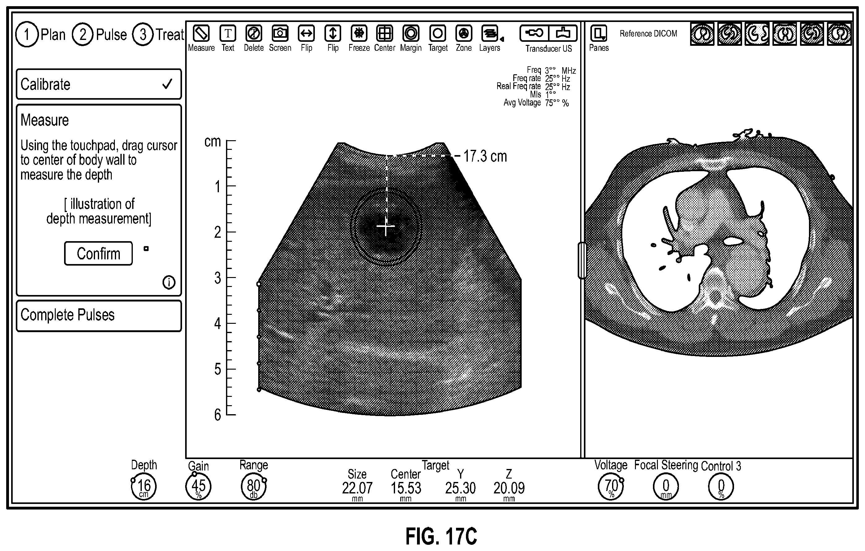 Patent US12599784 Figure 19 – Histotripsy systems and methods
