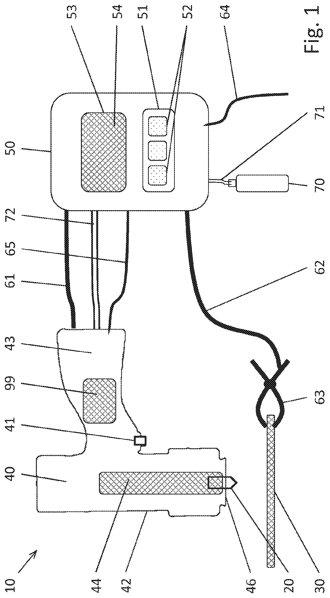 Patent US12599984 Figure 1 – Fastening method