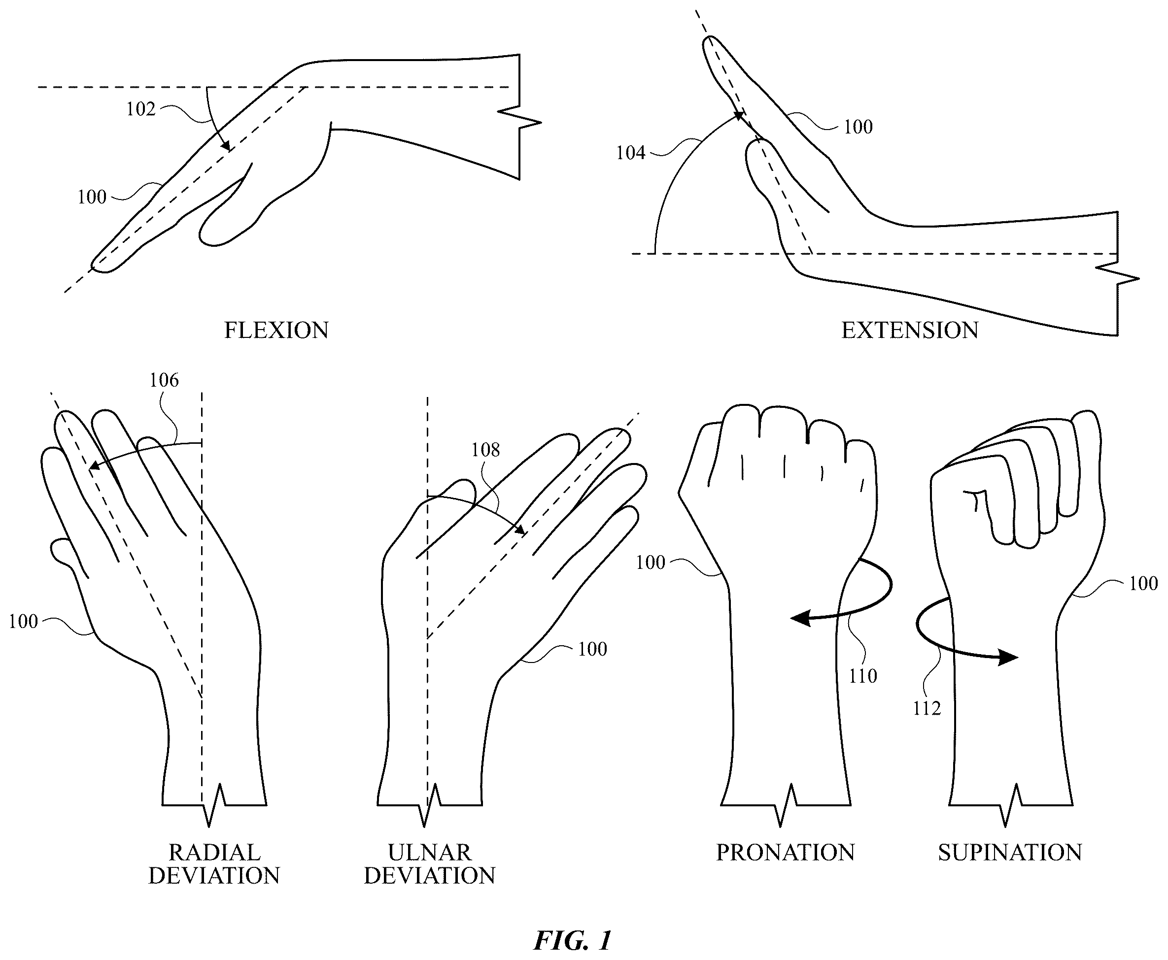 Patent US12602114 — Electrodes for gesture recognition — Figure 1