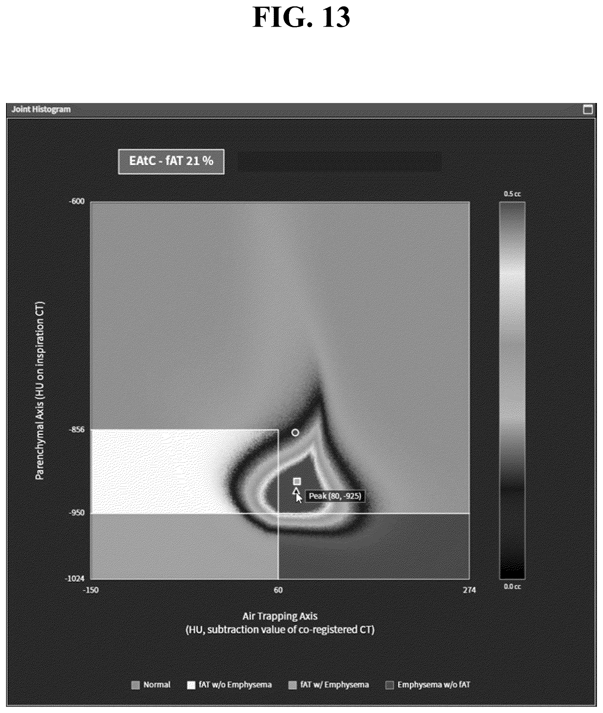 Patent US12602777 Figure 13 – Apparatus and method for quantitative assessment of medical images for diagnosis of chronic obstructive pulmonary disease