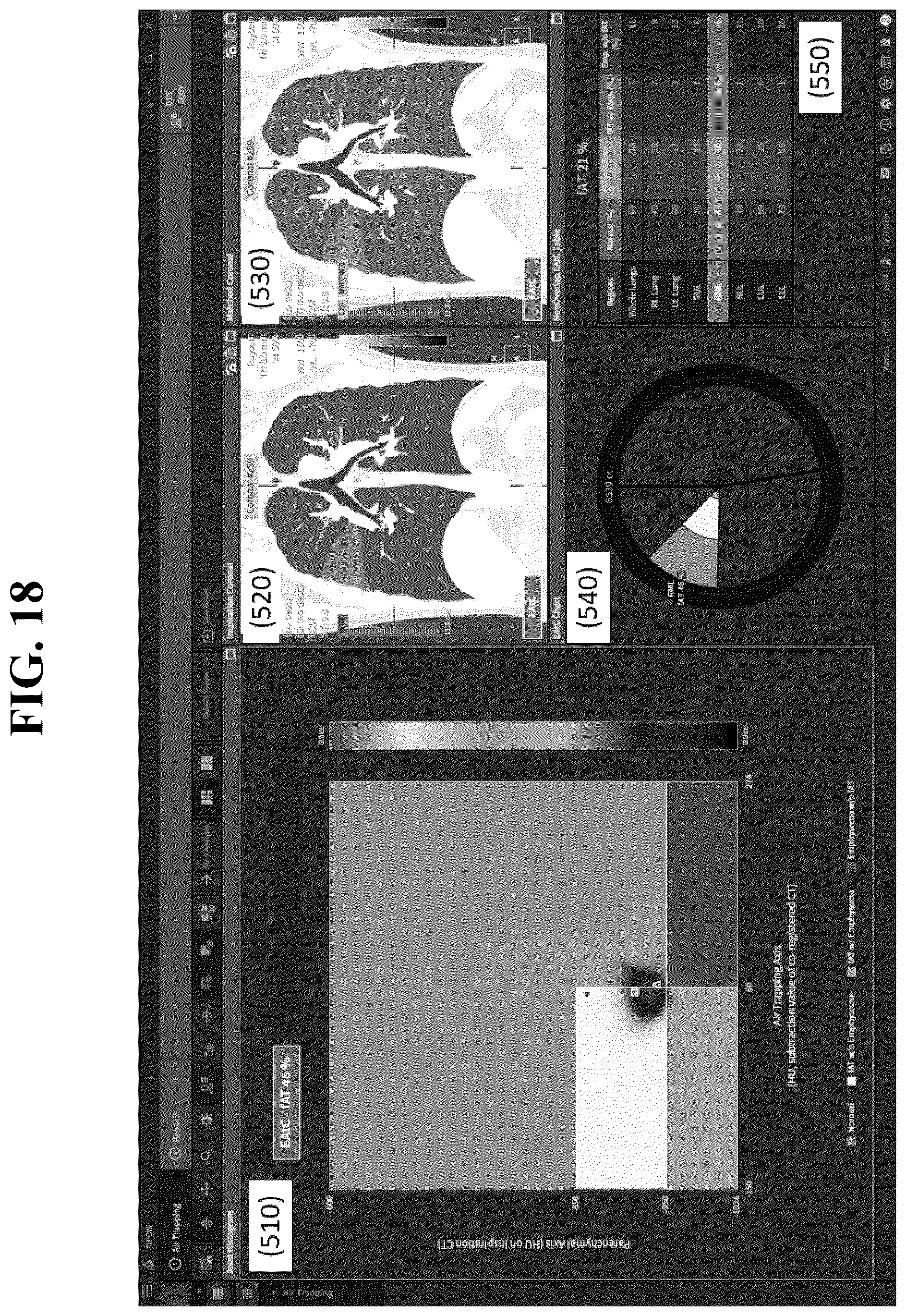 Patent US12602777 Figure 18 – Apparatus and method for quantitative assessment of medical images for diagnosis of chronic obstructive pulmonary disease