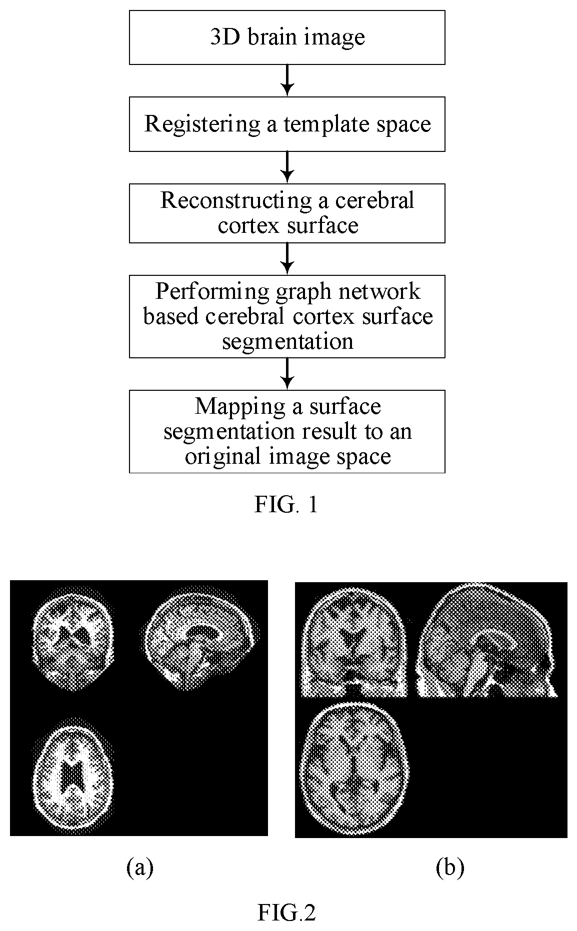 Patent US12602788 — Method and system for fully automatically segmenting cerebral cortex surface based on graph network — Figure 1