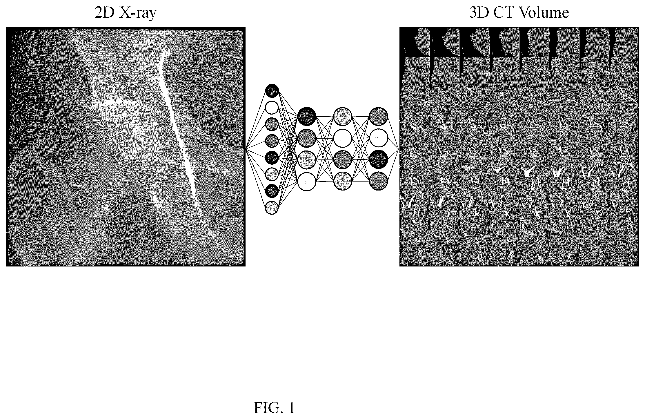 Patent US12602860 — Method for constructing three-dimensional medical image — Figure 1