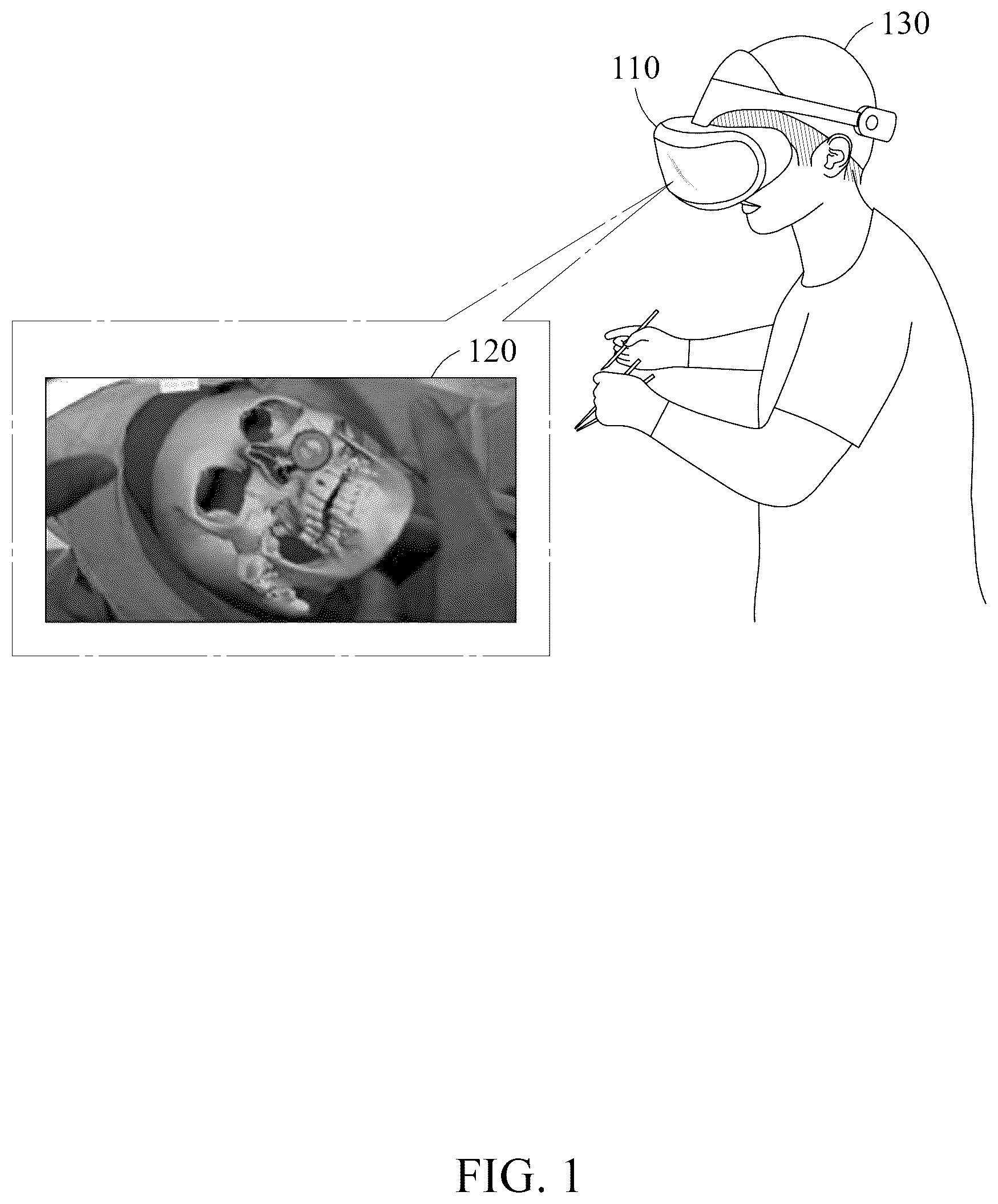 Patent US12602879 Figure 1 – Method and device for providing surgical guide using augmented reality