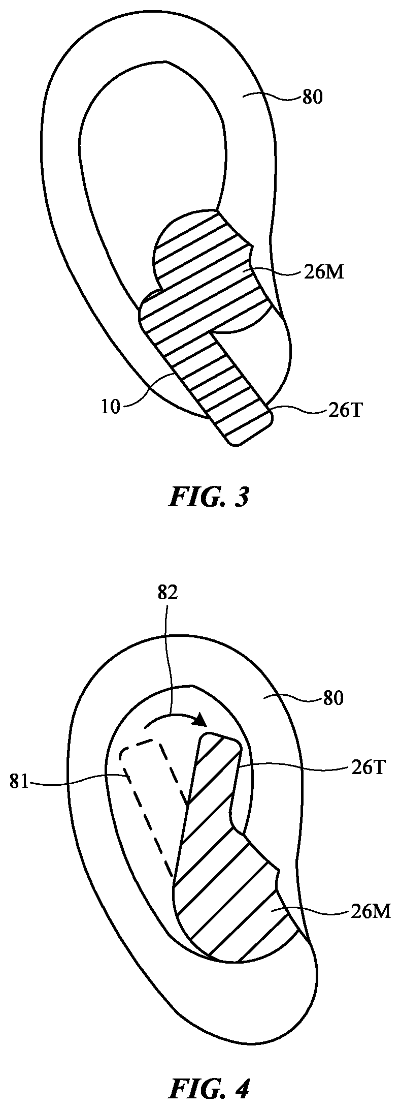 Patent US12610171 Figure 3 – Earbuds