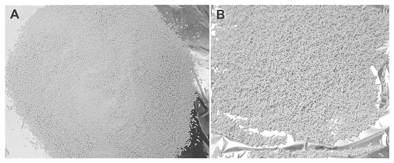 Patent US12610951 — Process for preparing 1-amino-1-cyclopropanecarboxylic acid granules — Figure 1