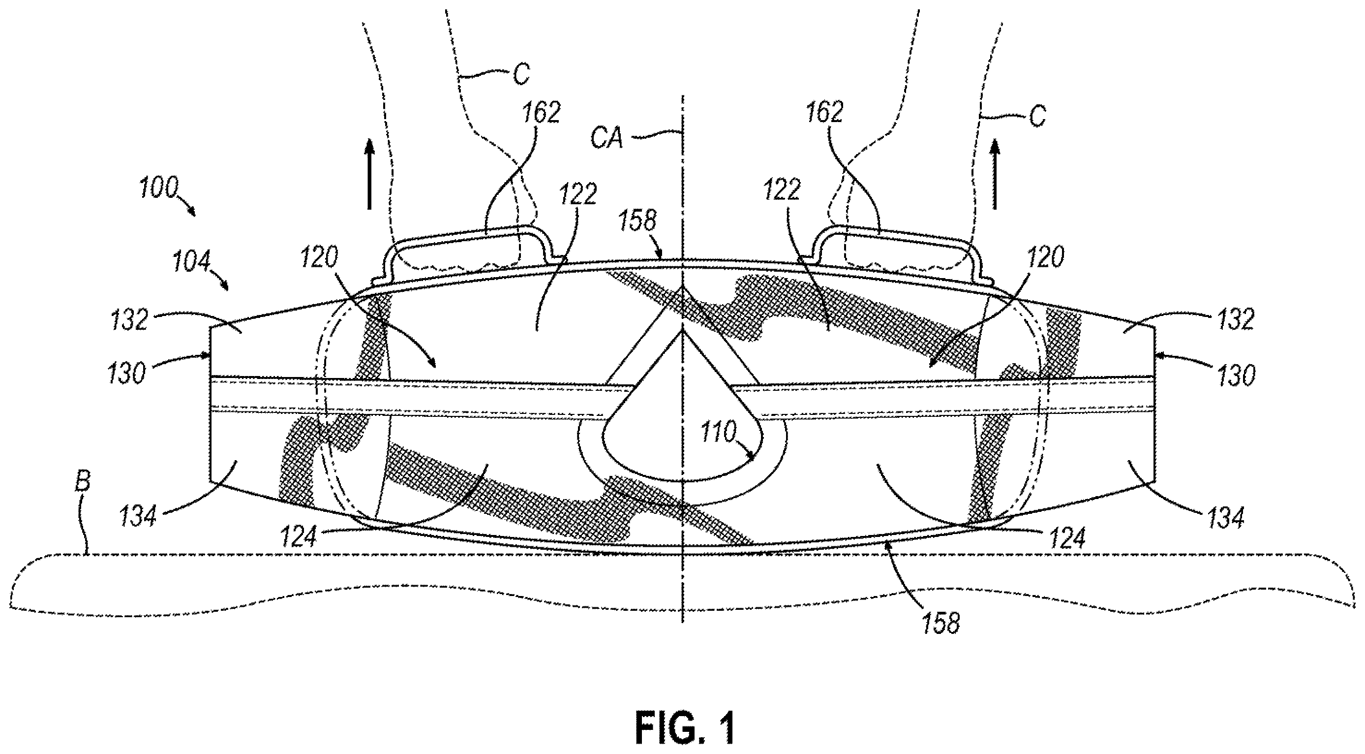 Patent US12610993 — Patient clothing system with integrated lifting features — Figure 1
