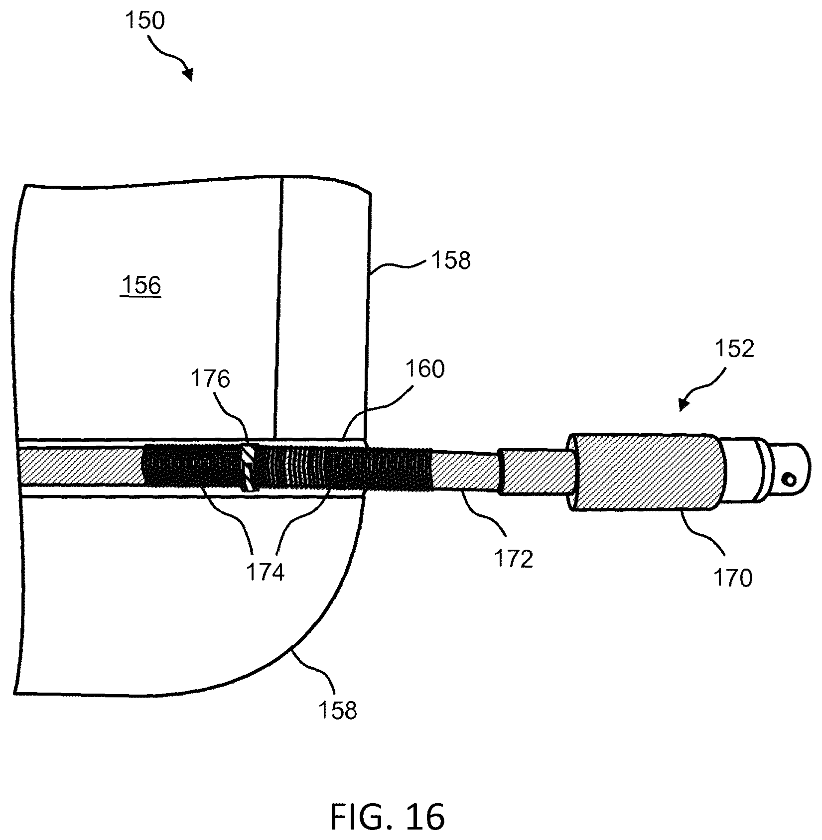 Patent US12611026 Figure 17 – Wearable and replaceable pouch or skin for holding a portable battery pack