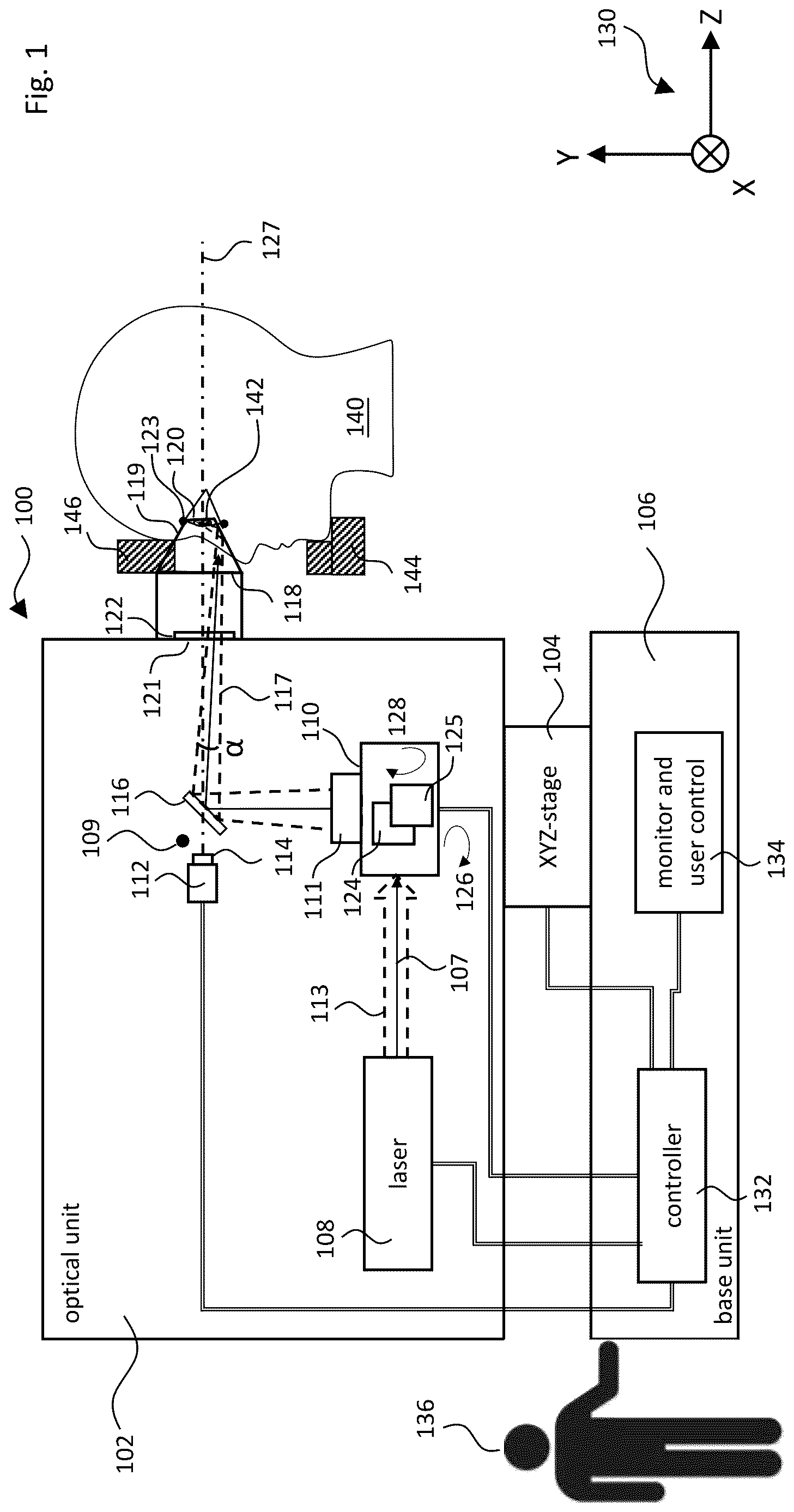 Patent US12611101 Figure 1 – Gonioscopic laser surgery