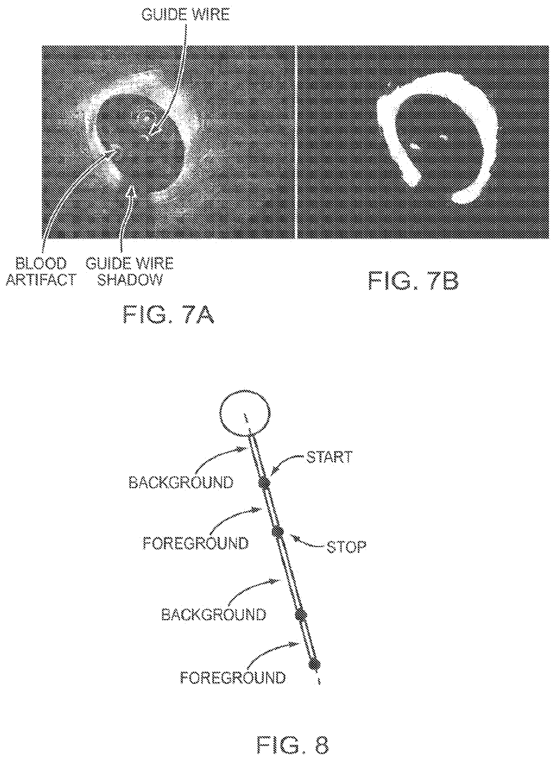 Patent US12611107 Figure 8 – Lumen morphology and vascular resistance measurements data collection systems, apparatus and methods
