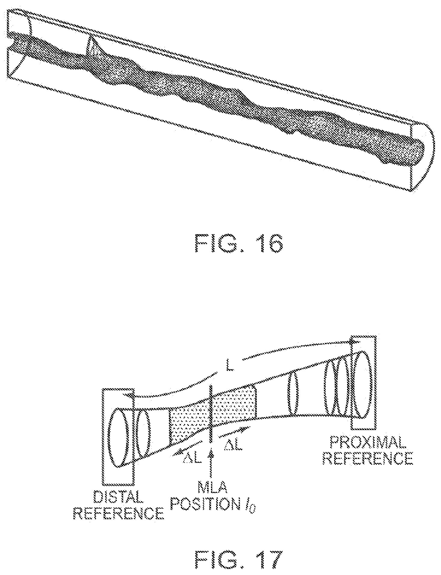 Patent US12611107 Figure 15 – Lumen morphology and vascular resistance measurements data collection systems, apparatus and methods