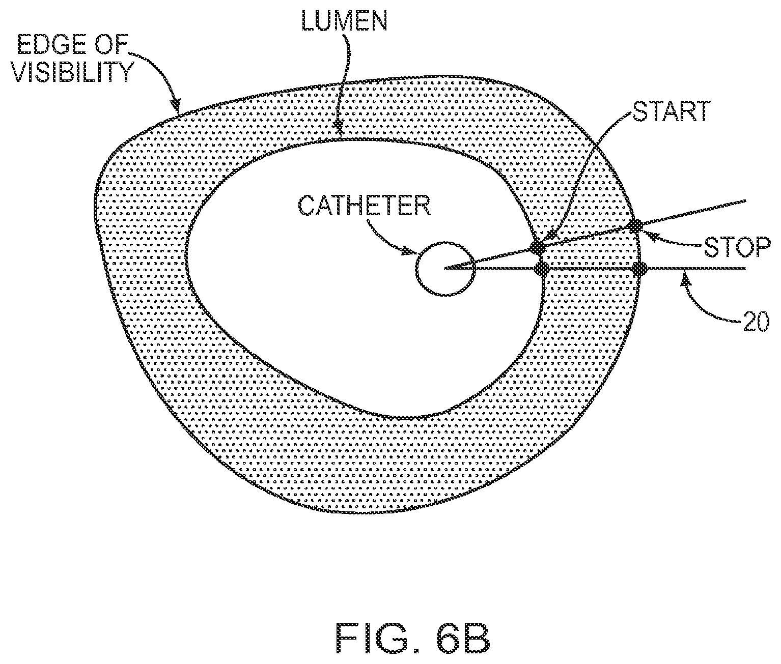 Patent US12611108 Figure 7 – Lumen morphology and vascular resistance measurements data collection systems apparatus and methods