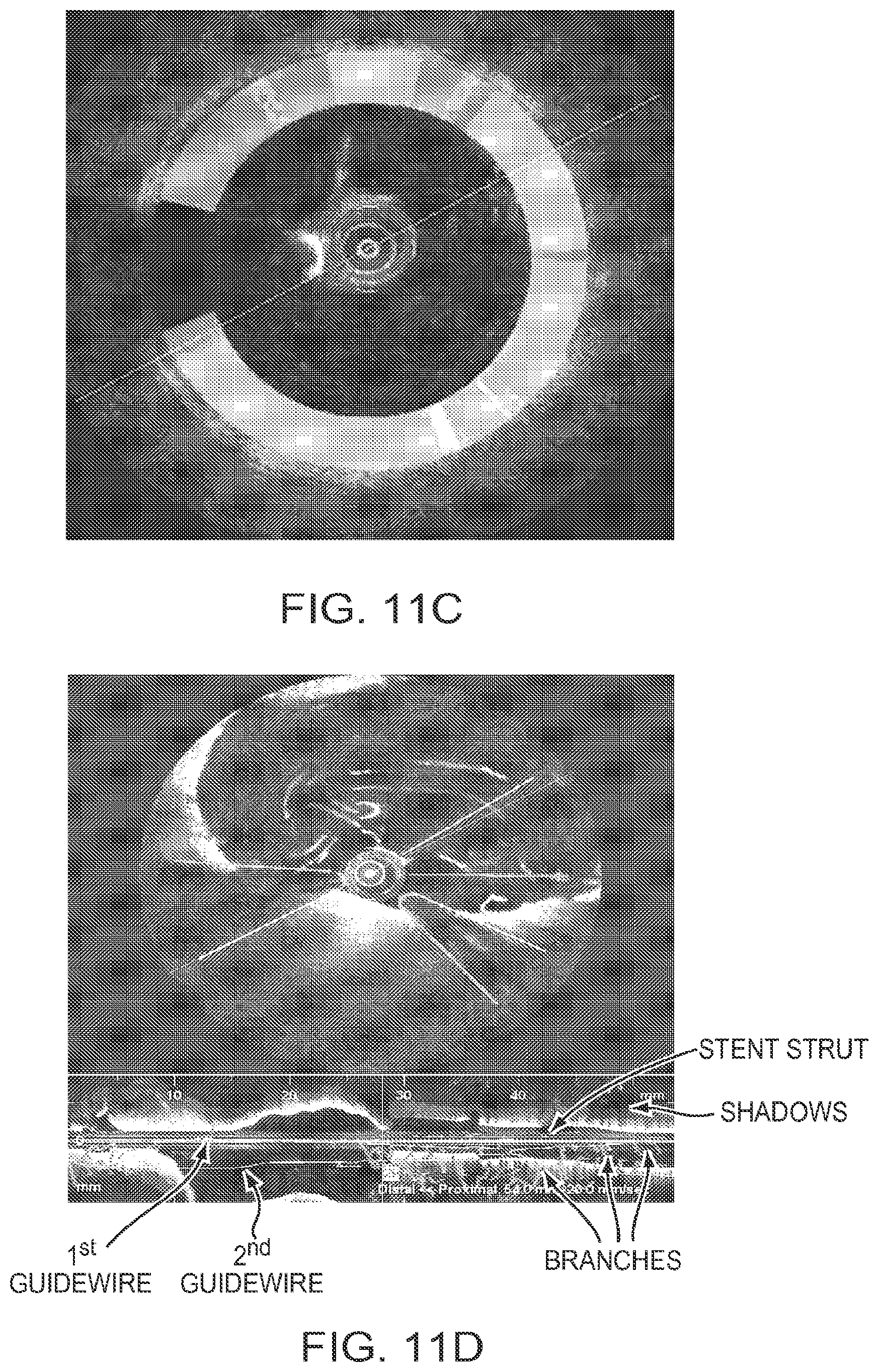 Patent US12611108 Figure 11 – Lumen morphology and vascular resistance measurements data collection systems apparatus and methods