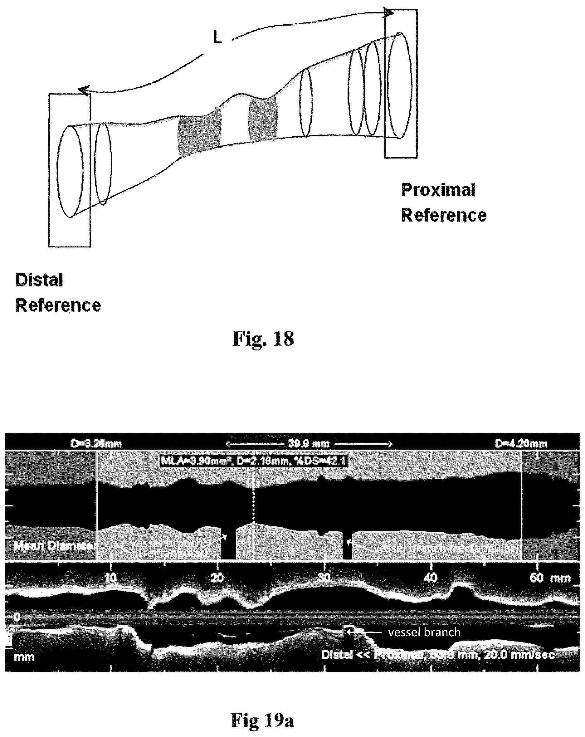 Patent US12611108 Figure 16 – Lumen morphology and vascular resistance measurements data collection systems apparatus and methods