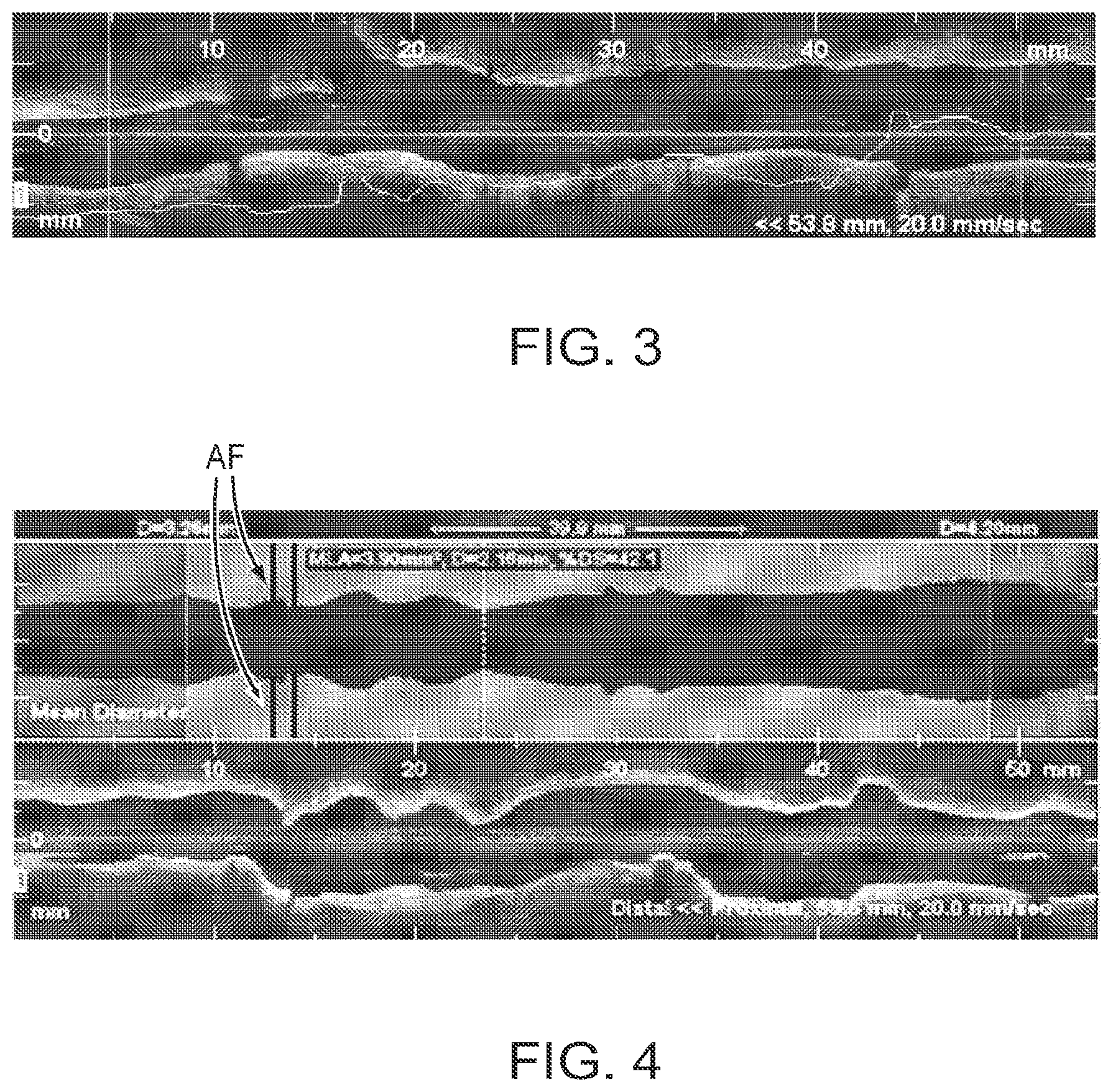 Patent US12611109 Figure 4 – Lumen morphology and vascular resistance measurements data collection systems apparatus and methods
