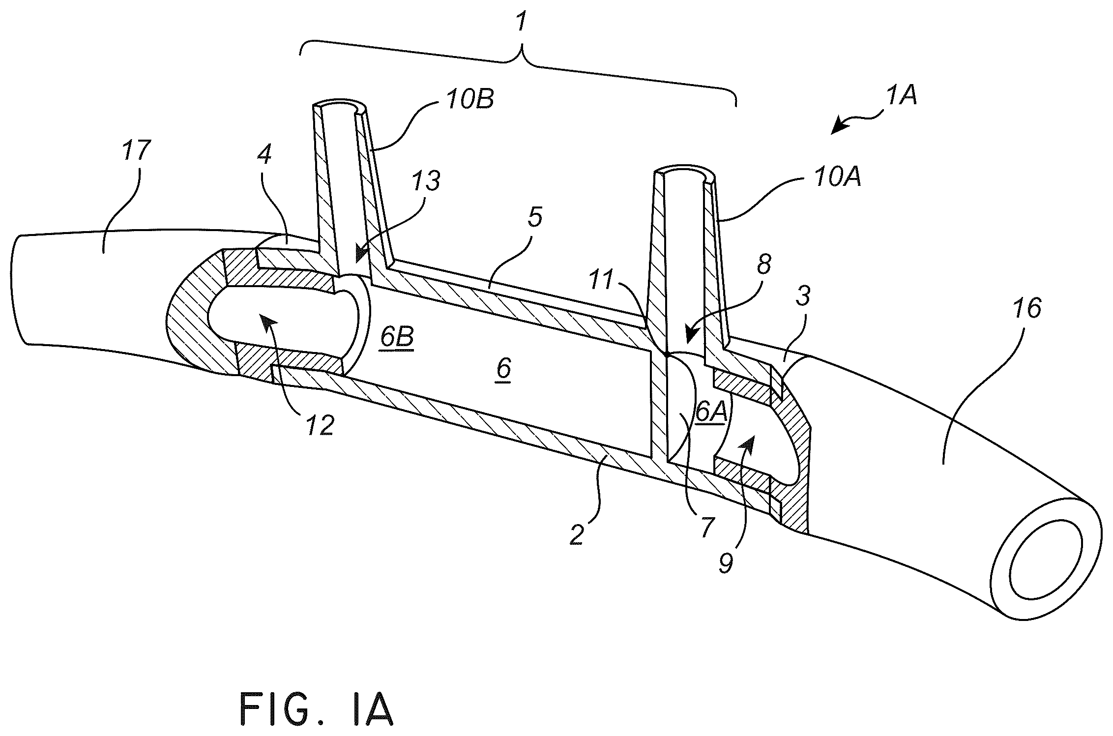 Patent US12611117 Figure 1 – Nasal/oral cannula system and manufacturing