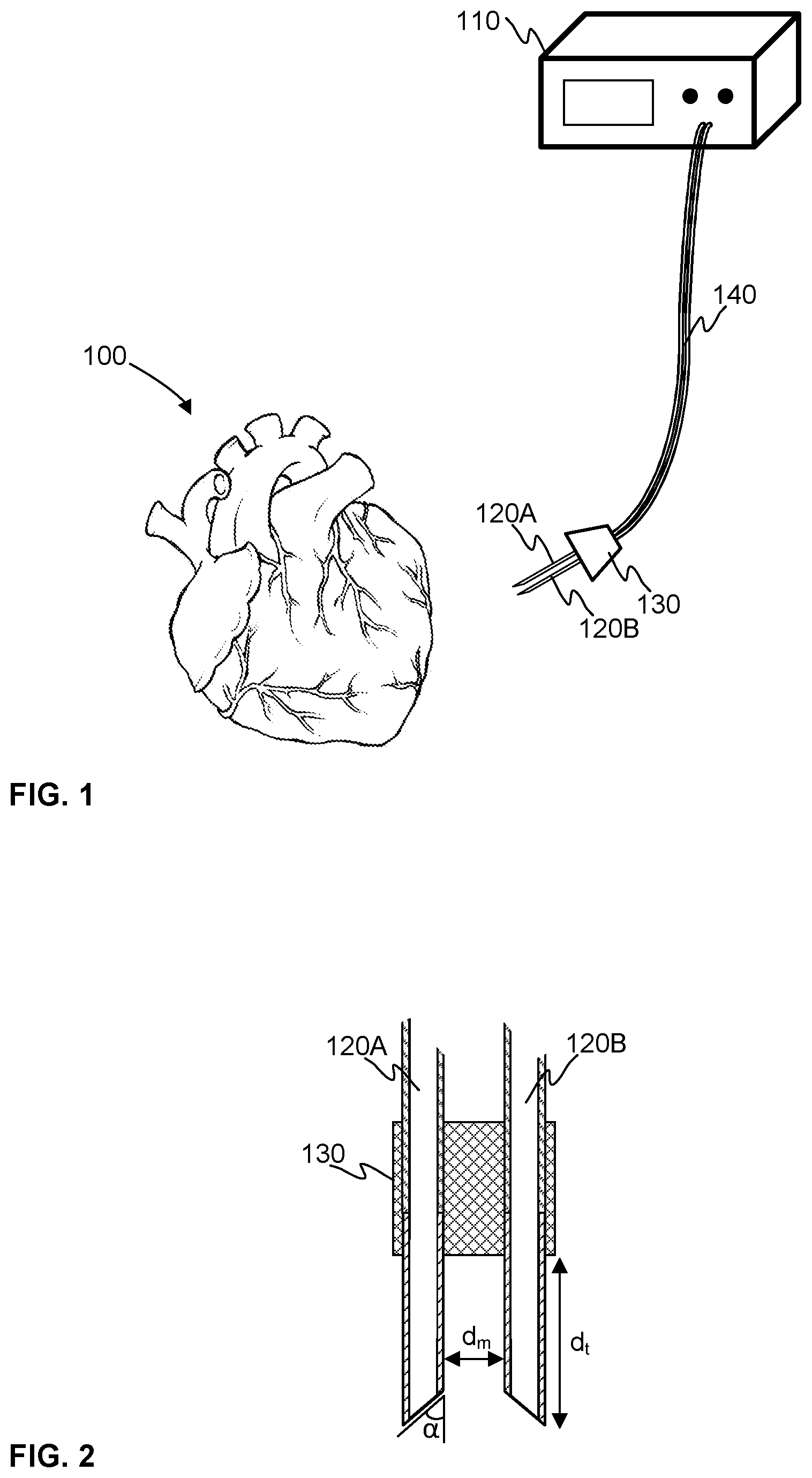 Patent US12611123 — Myocardial spectrometer probe and a method of monitoring the heart muscle — Figure 1