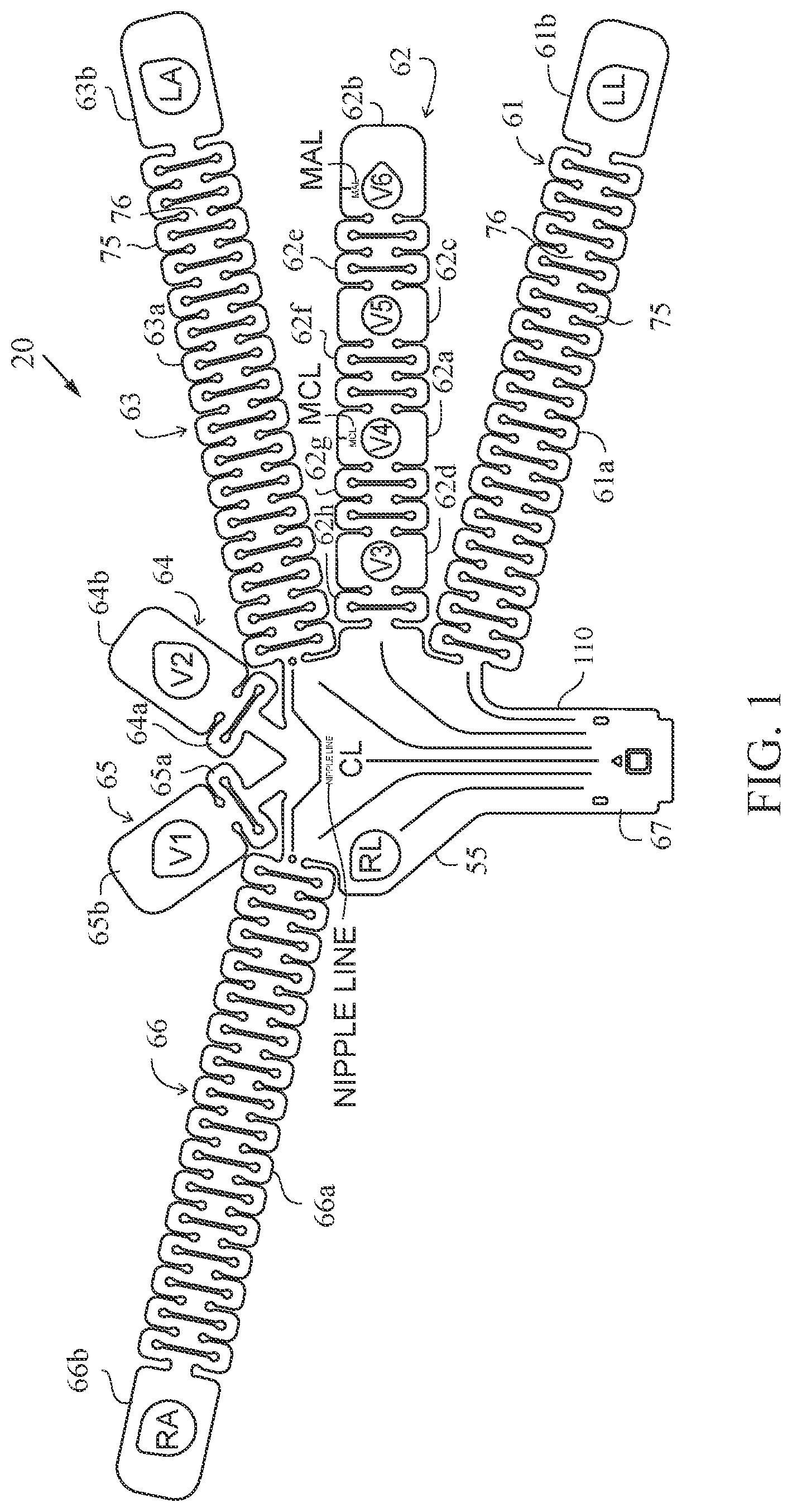 Patent US12611131 Figure 1 – Electrocardiogram apparatus