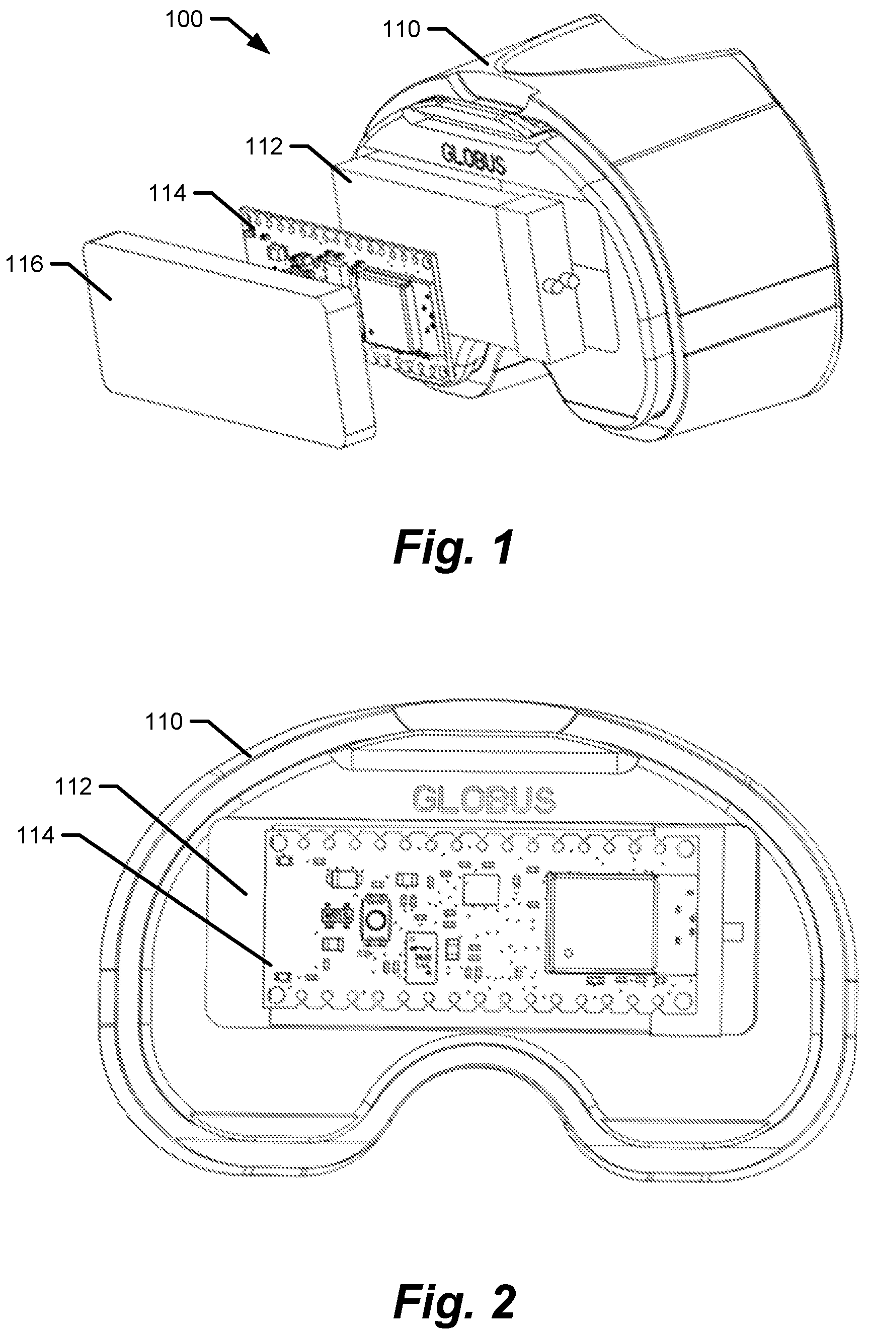 Patent US12611140 — Medical implants with circuits treating periprosthetic joint infection and other sensing — Figure 1