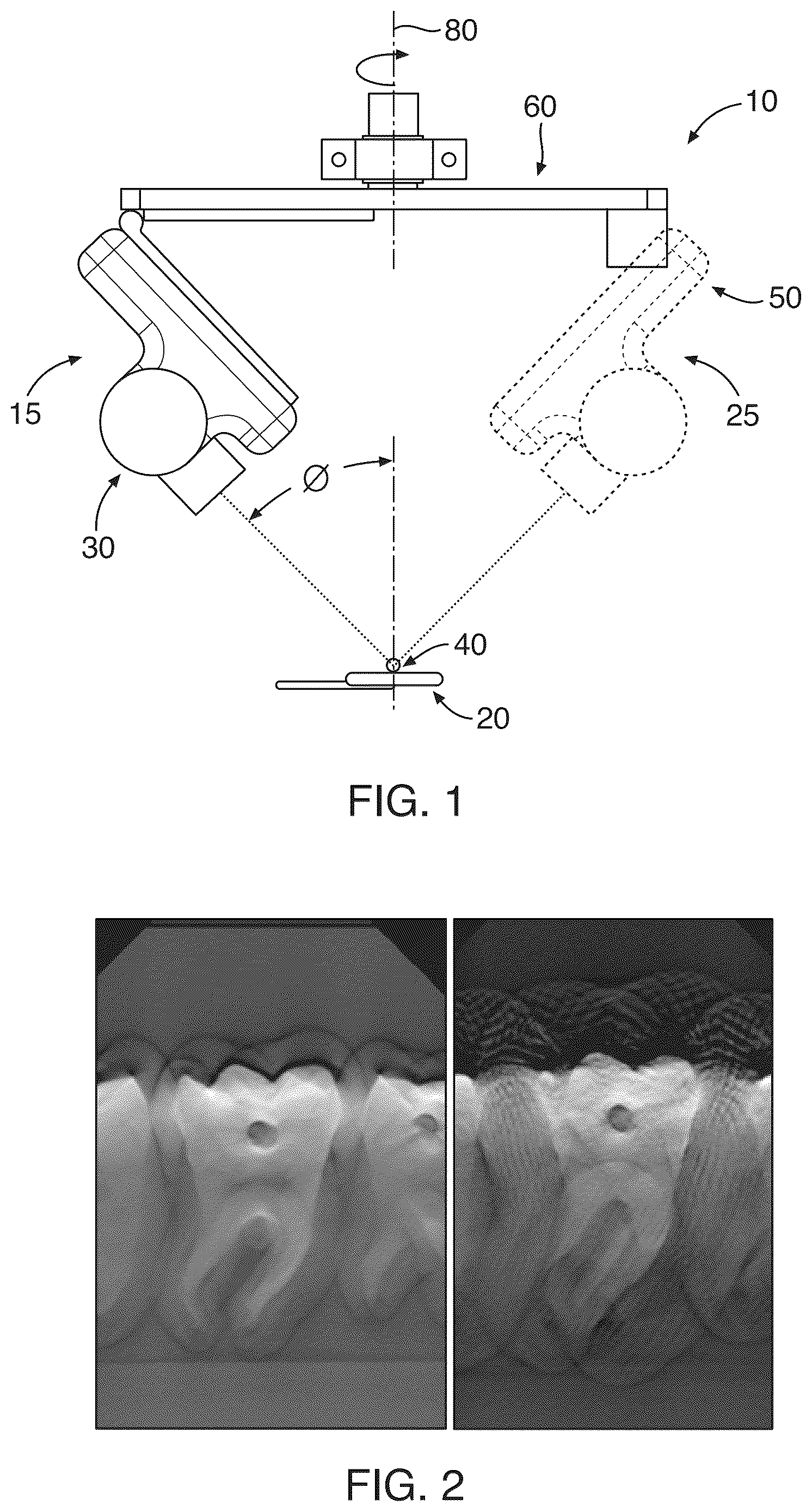 Patent US12611156 — Three dimensional x-ray imaging system — Figure 1