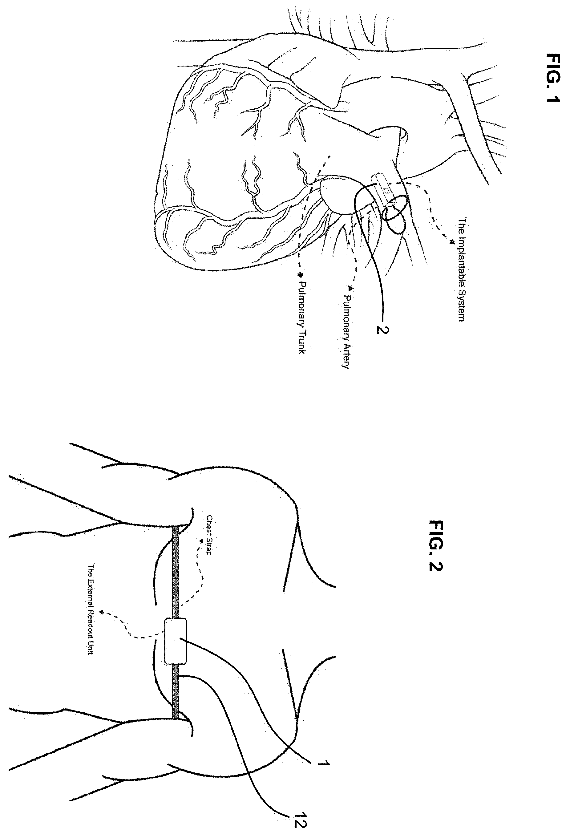 Patent US12611161 — Cardiovascular monitoring system — Figure 1