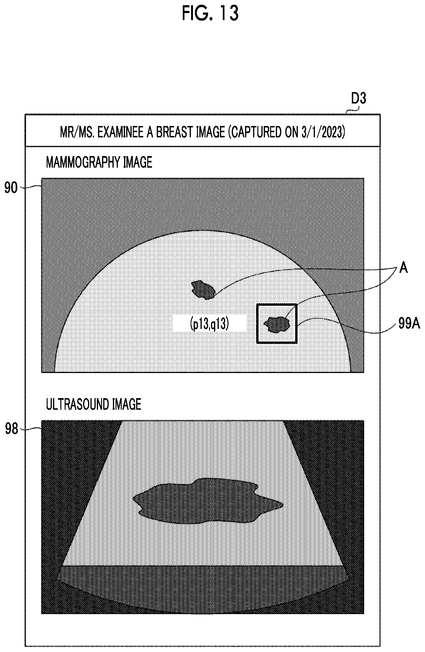 Patent US12611162 Figure 9 – Imaging apparatus and imaging system having drive device for moving ultrasound unit, and method of imaging ultrasound image with moving ultrasound unit