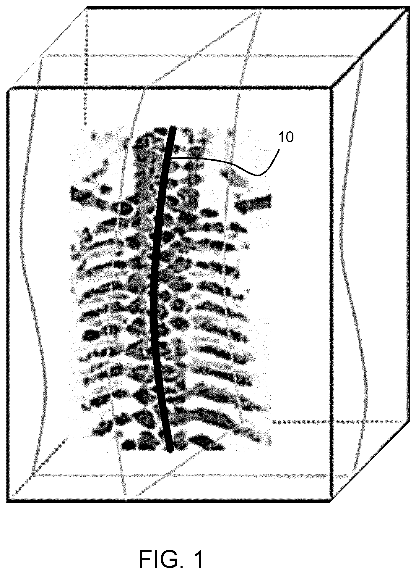 Patent US12611165 — Fetal ultrasound image processing — Figure 1
