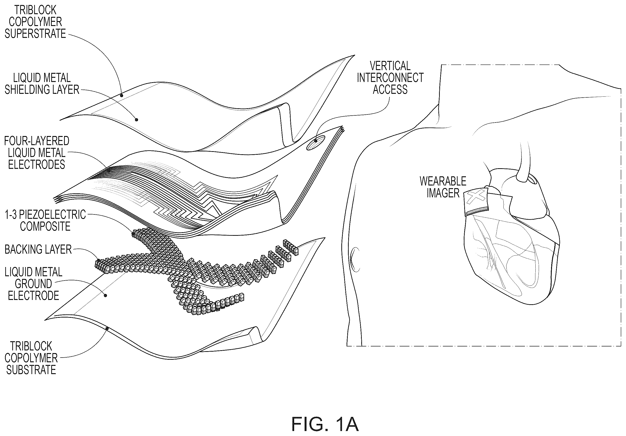 Patent US12611173 — Wearable ultrasound imaging device for imaging the heart and other internal tissue — Figure 1