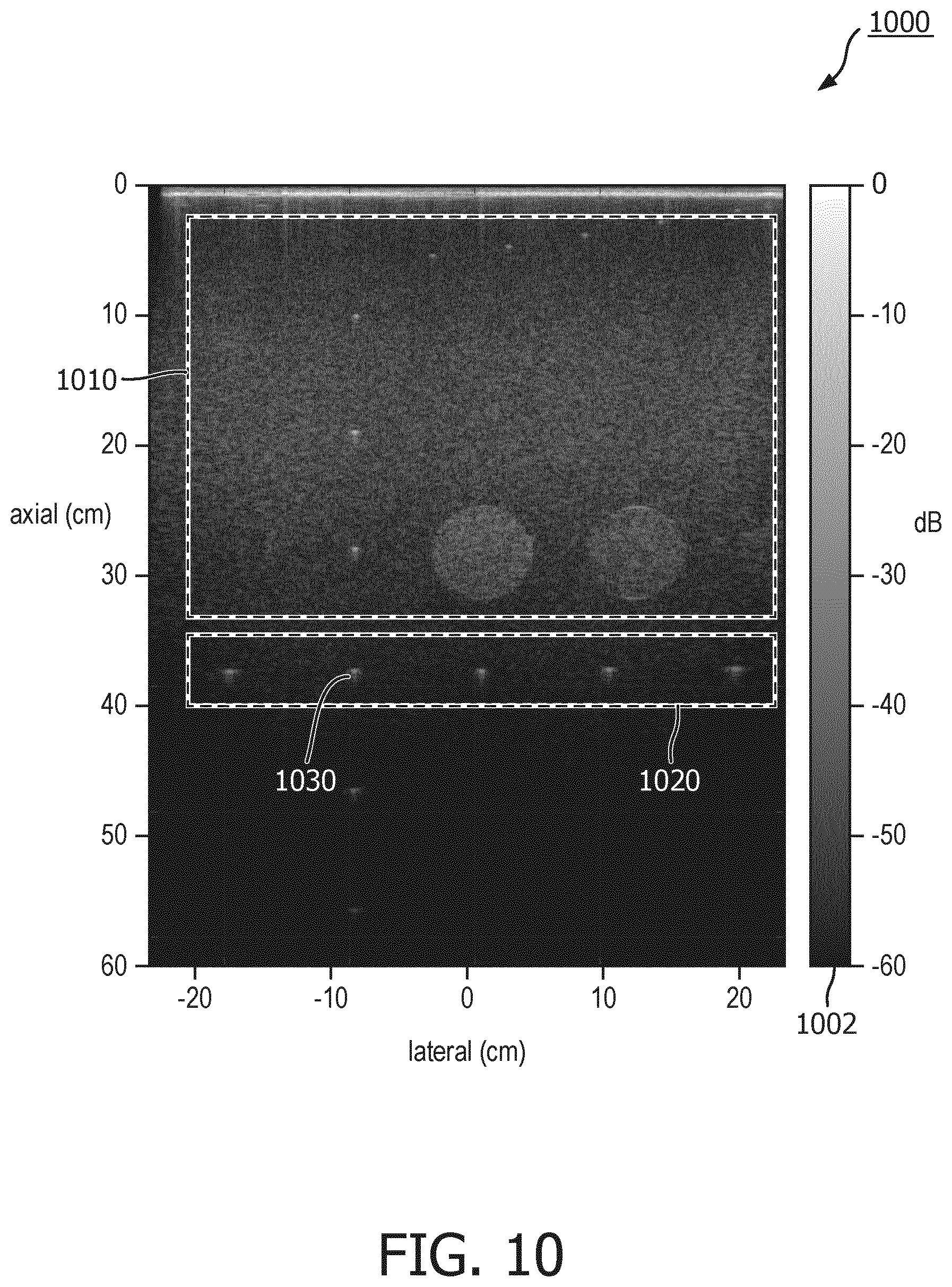 Patent US12611182 Figure 10 – Coherently compounded ultrasound image generation and associated systems, methods, and devices