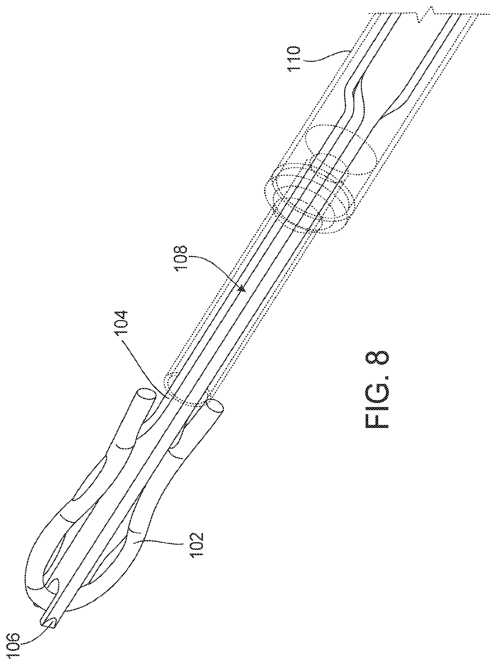 Patent US12611207 Figure 16 – Flexible anchor delivery system
