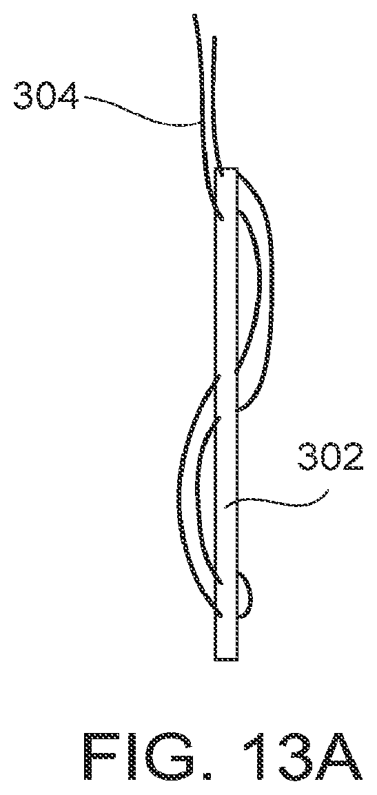 Patent US12611207 Figure 20 – Flexible anchor delivery system