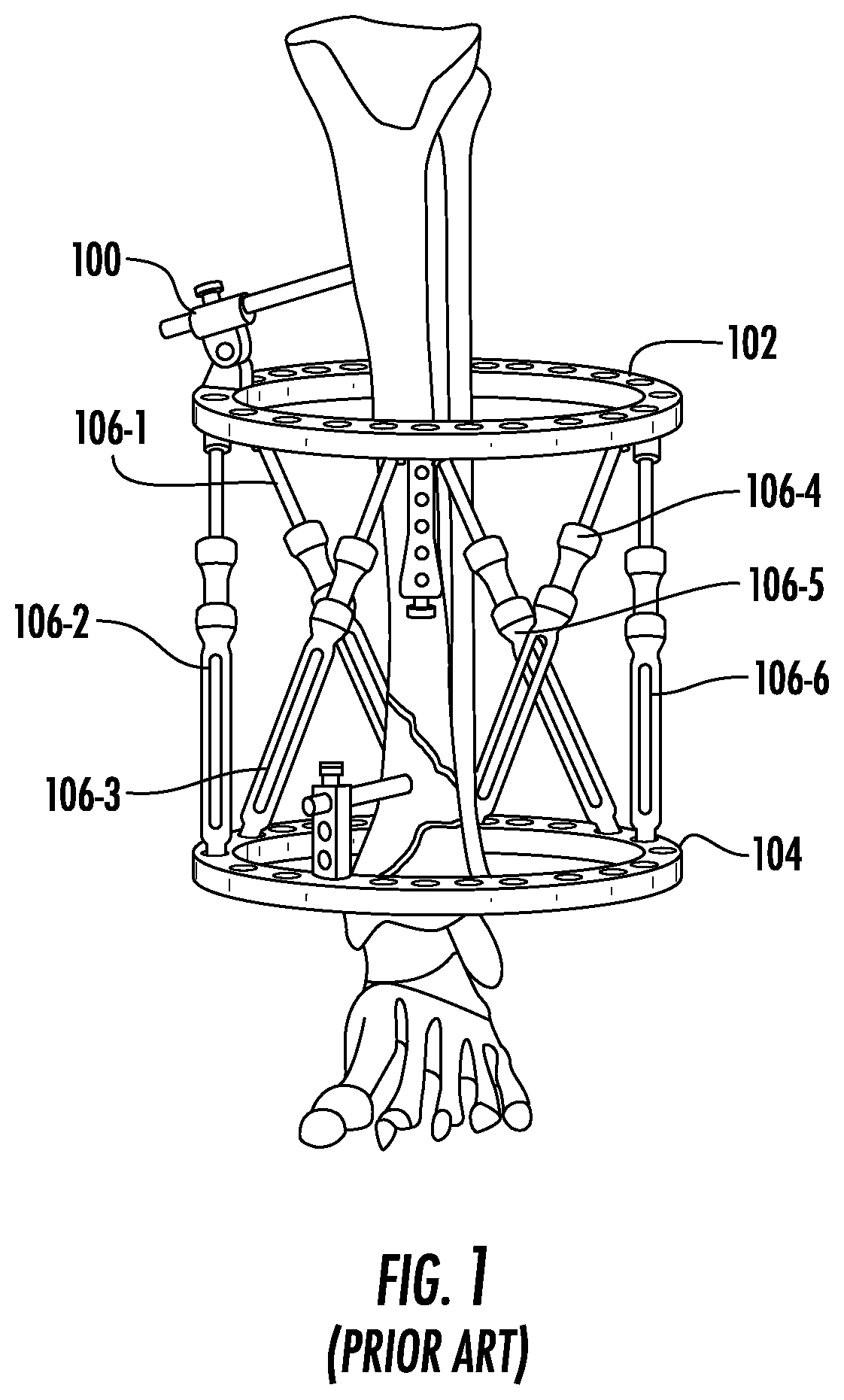 Patent US12611228 Figure 1 – Detachable geared-motor assembly for motorizing a strut in a spatial frame