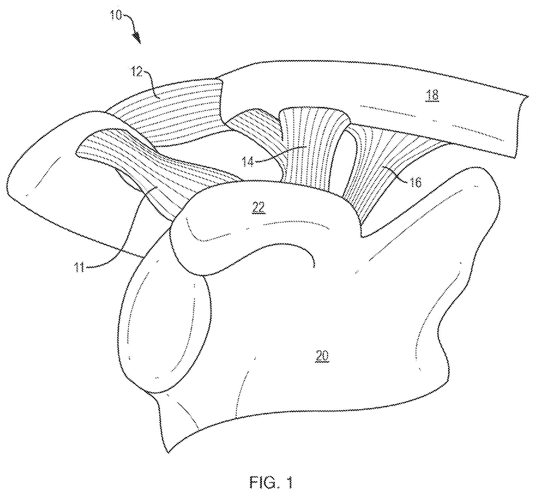 Patent US12611230 — Methods and systems related to joint repair — Figure 1