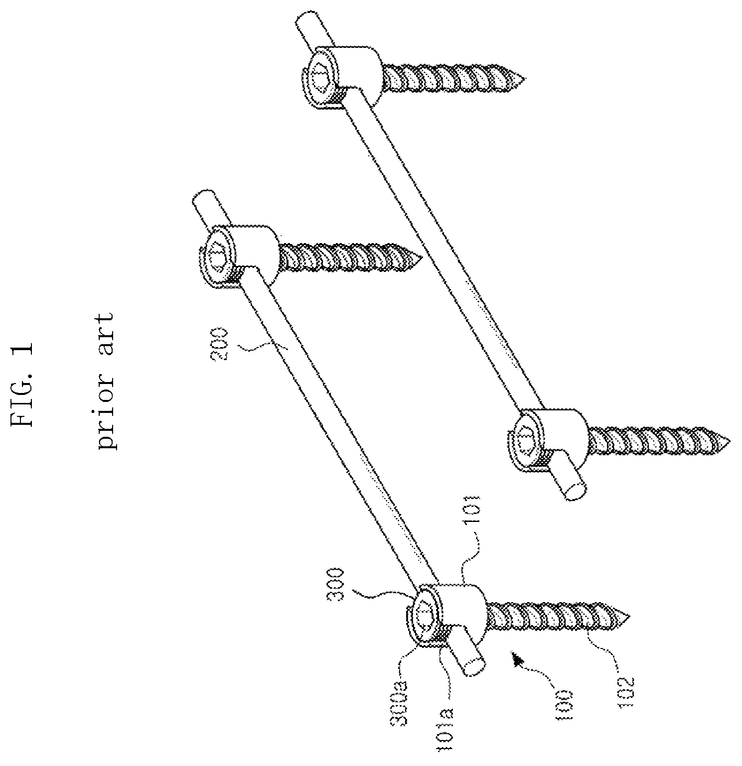 Patent US12611232 — Bio-flexible spinal fixation apparatus for preventing fatigue fracture — Figure 1