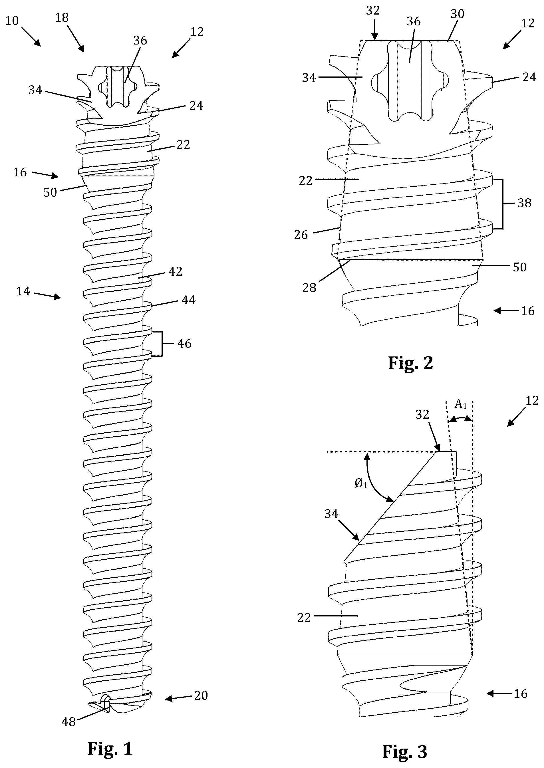 Patent US12611239 — Orthopedic bone screw — Figure 1