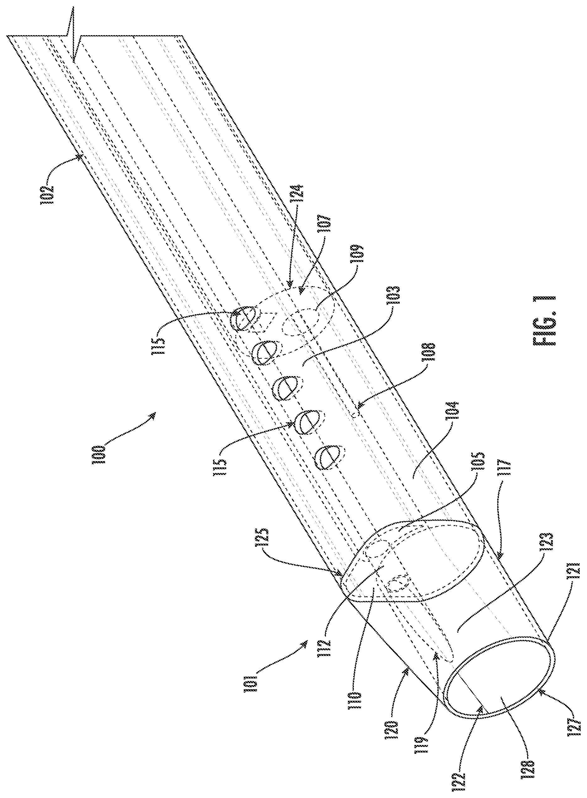 Patent US12611251 — Devices, assemblies, and methods for removal of a bodily mass — Figure 1
