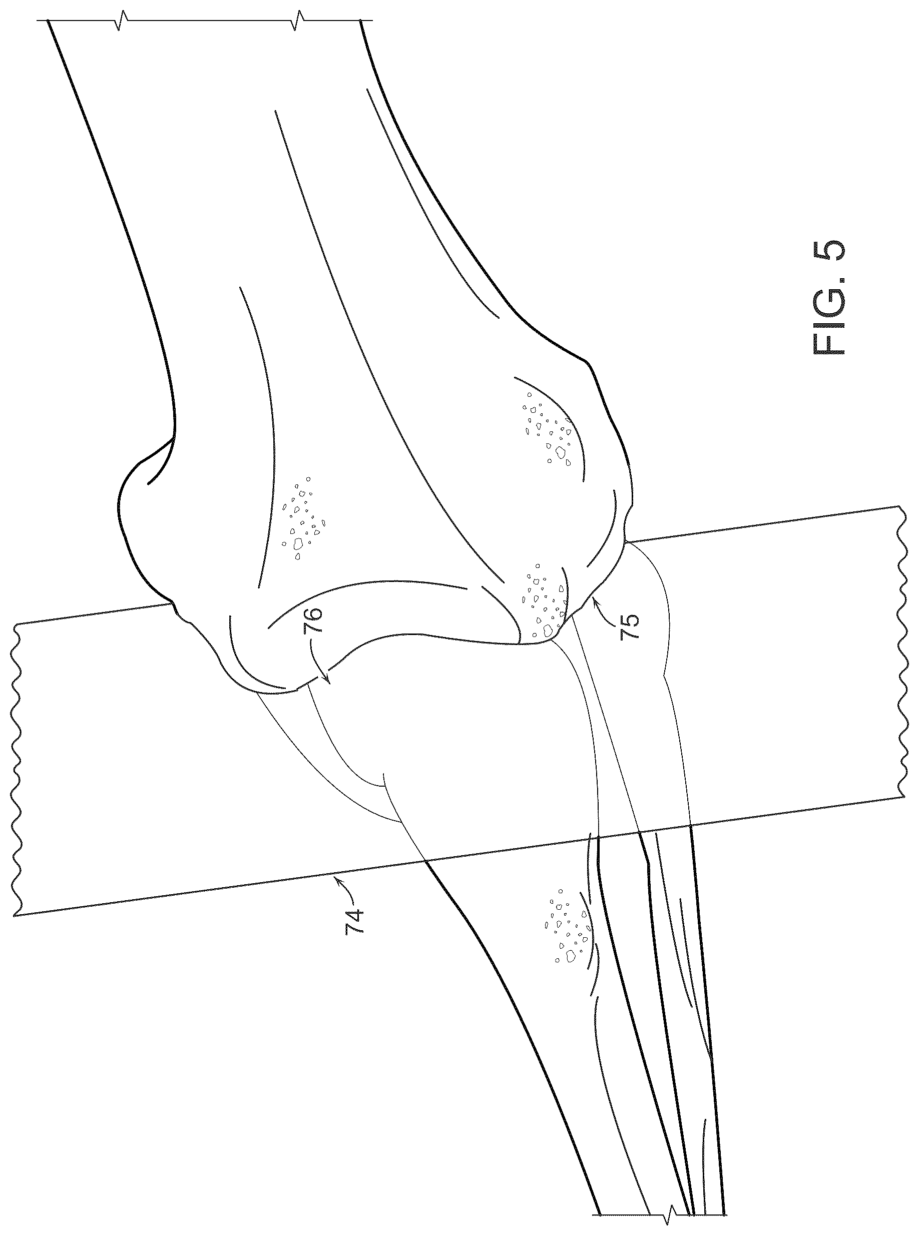 Patent US12611256 Figure 7 – Systems for superimposing a virtual display on a physical spine